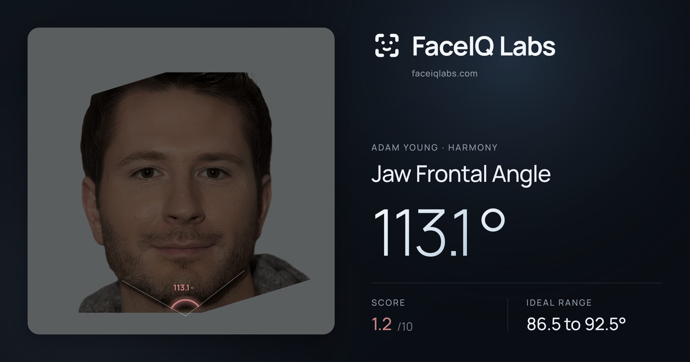 Adam Young Jaw Frontal Angle: 113.1°, drawn on the photo