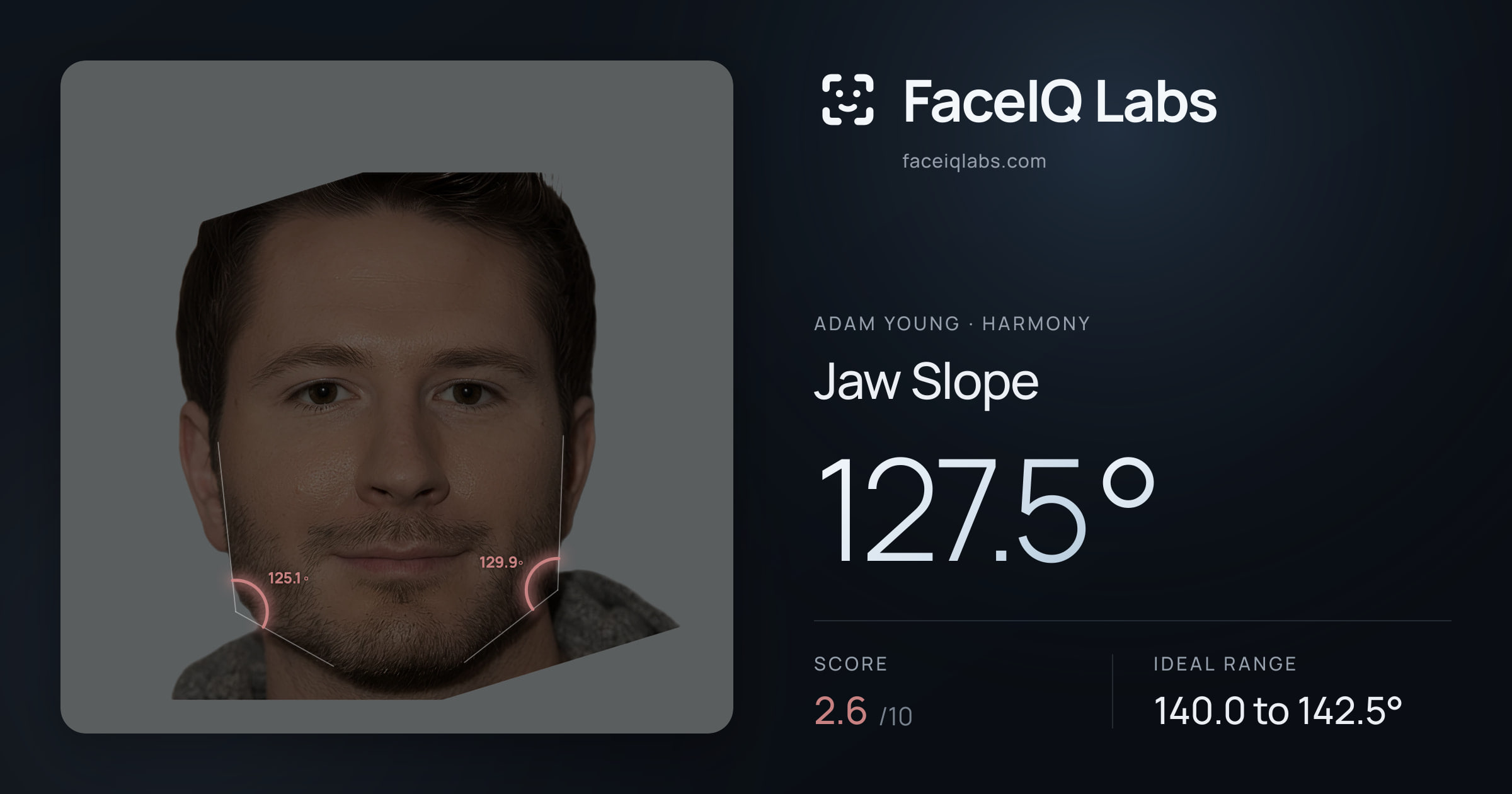 Adam Young Jaw Slope: 127.5°, drawn on the photo