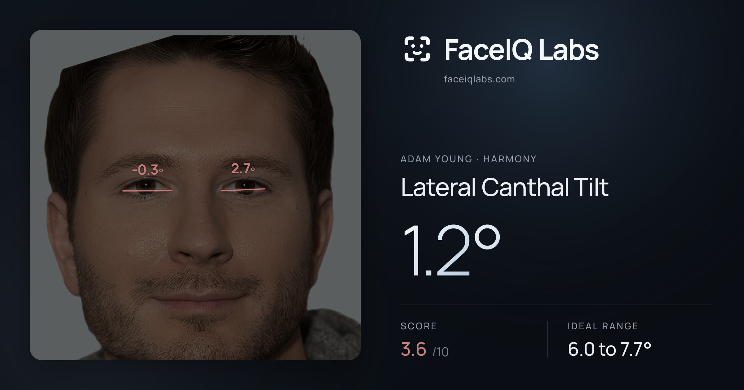 Adam Young Lateral Canthal Tilt: 1.2°, drawn on the photo