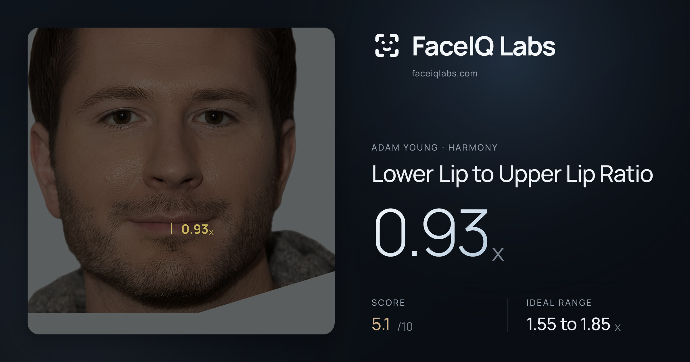 Adam Young Lower Lip to Upper Lip Ratio: 0.93x, drawn on the photo