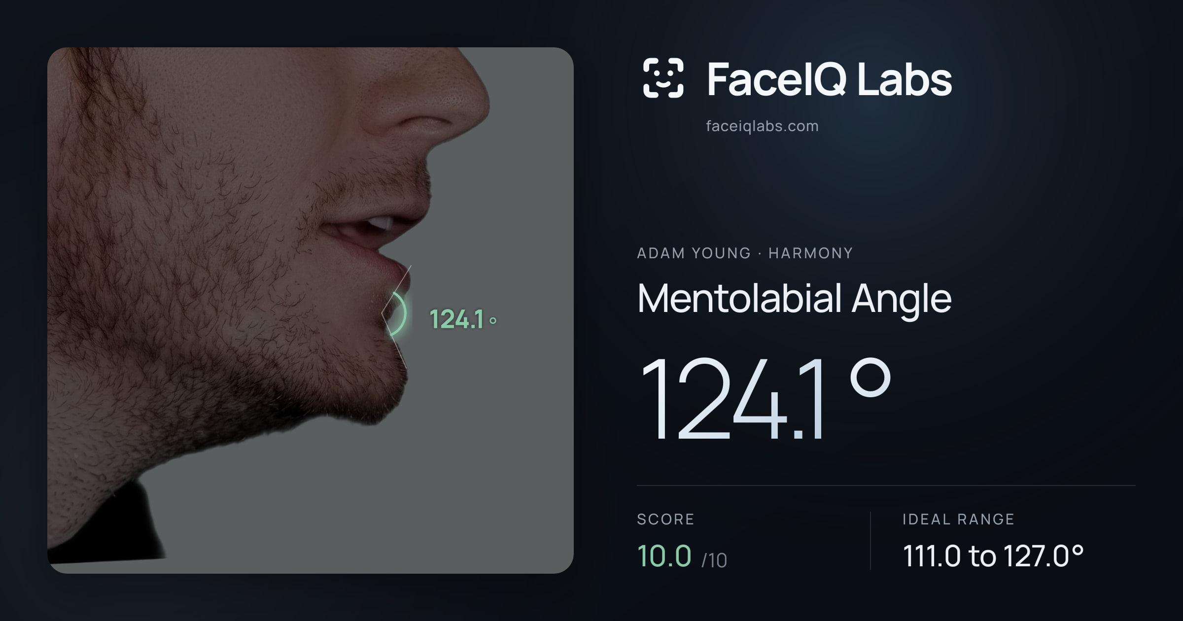 Adam Young Mentolabial Angle: 124.1°, drawn on the photo