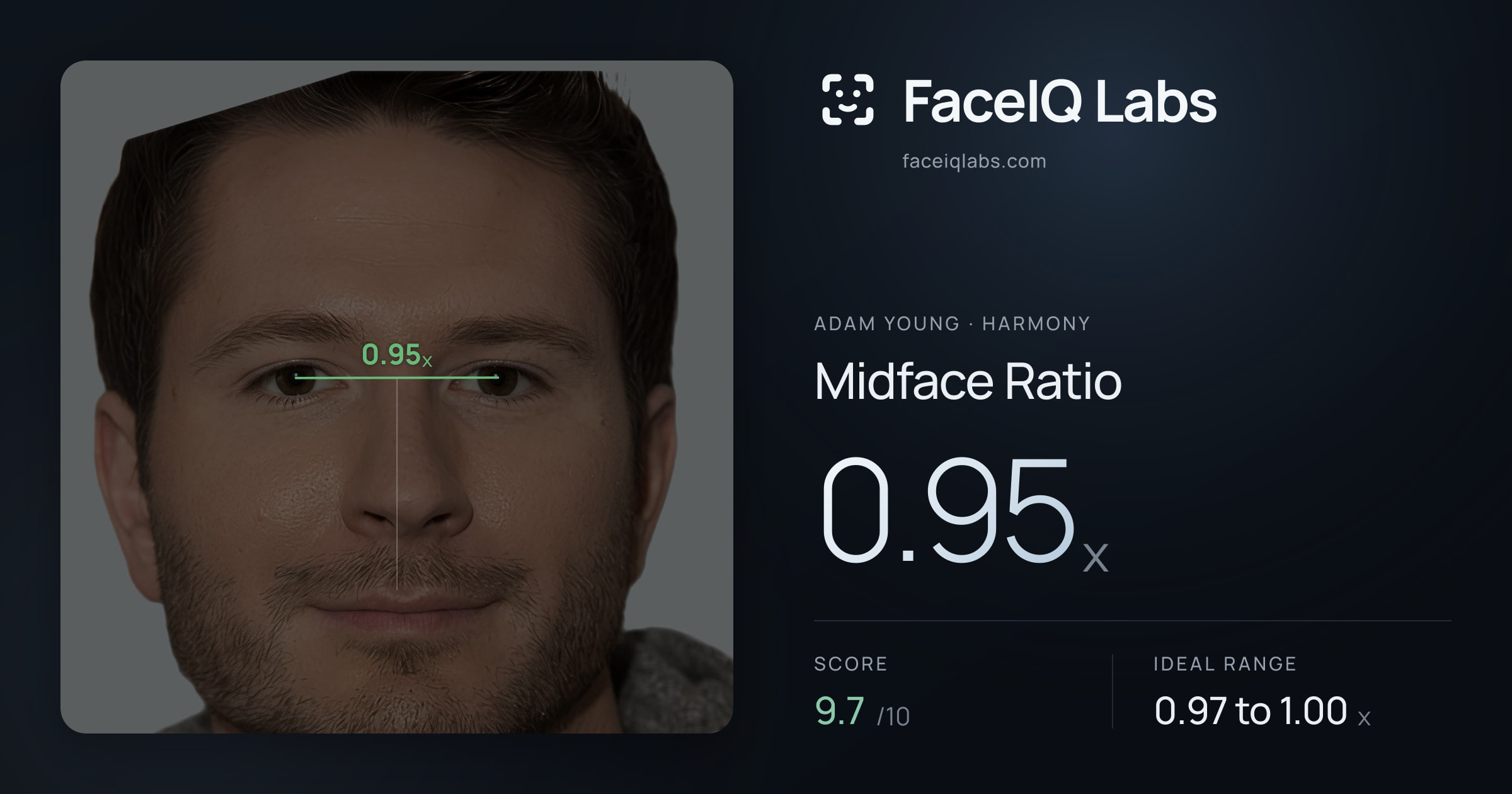 Adam Young Midface Ratio: 0.95x, drawn on the photo