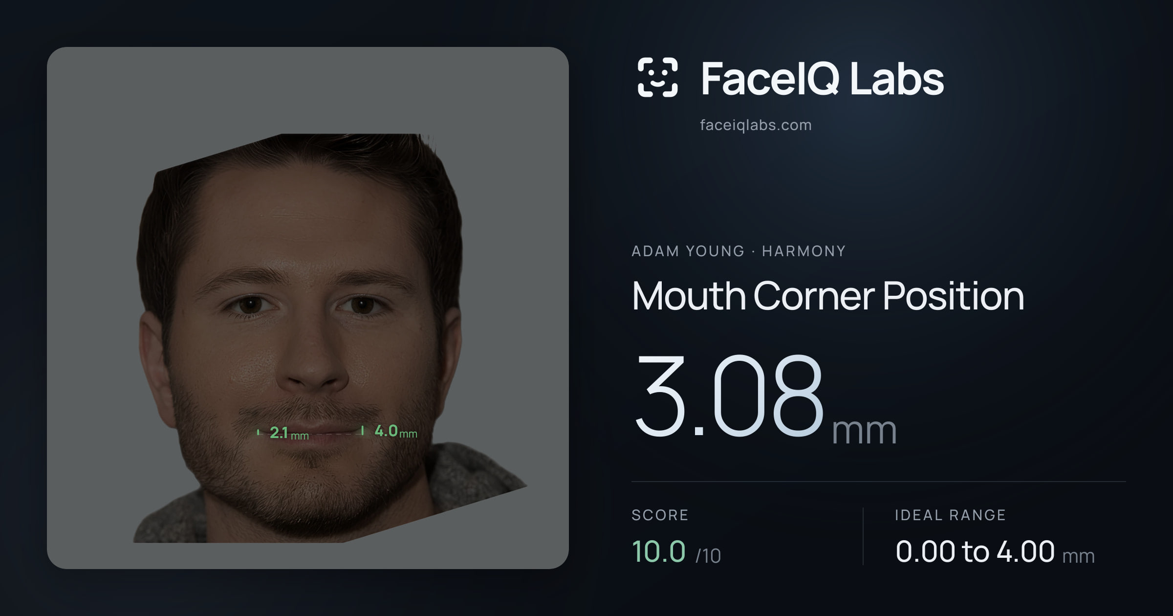 Adam Young Mouth Corner Position: 3.08mm, drawn on the photo