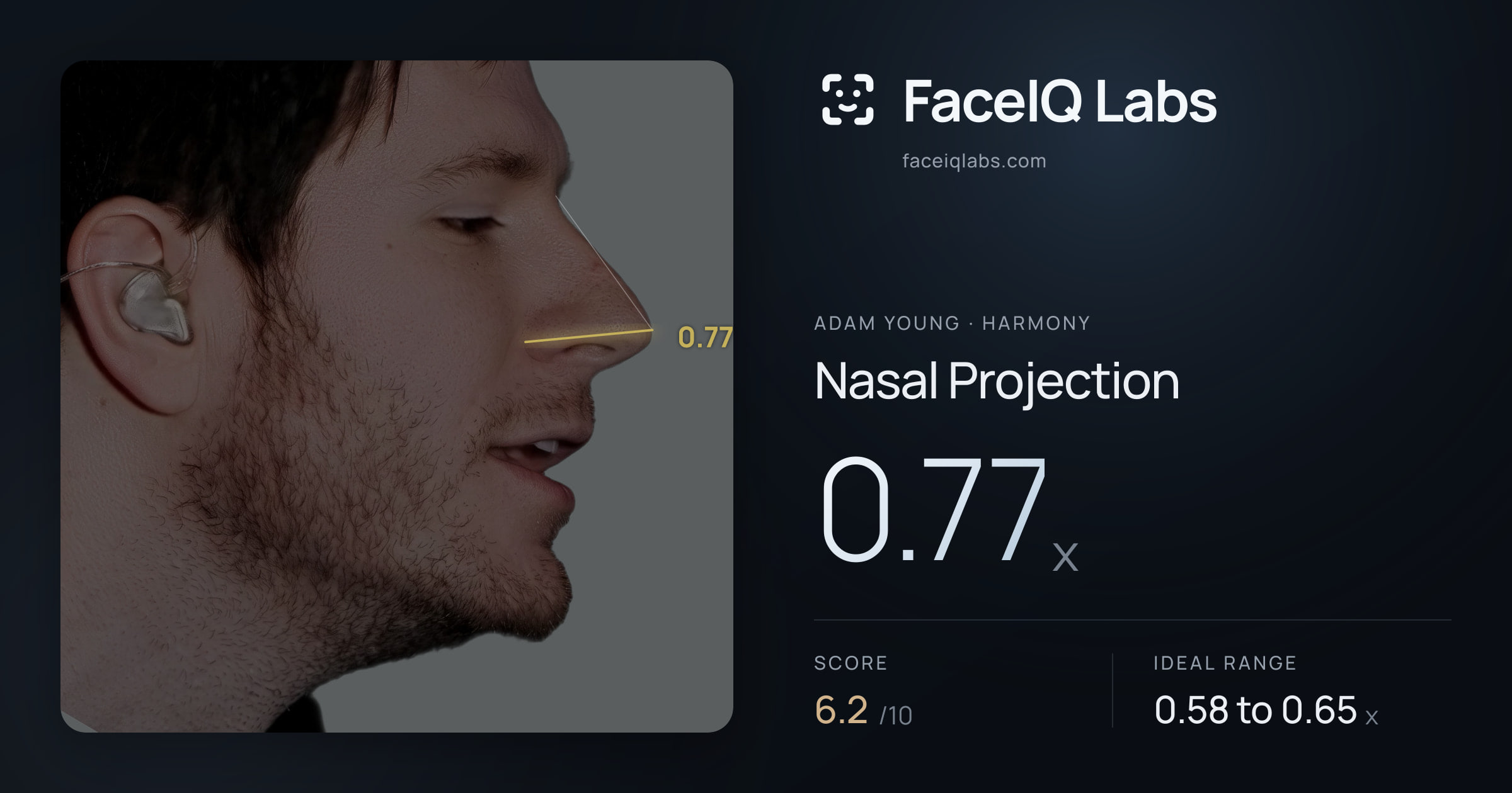Adam Young Nasal Projection: 0.77x, drawn on the photo