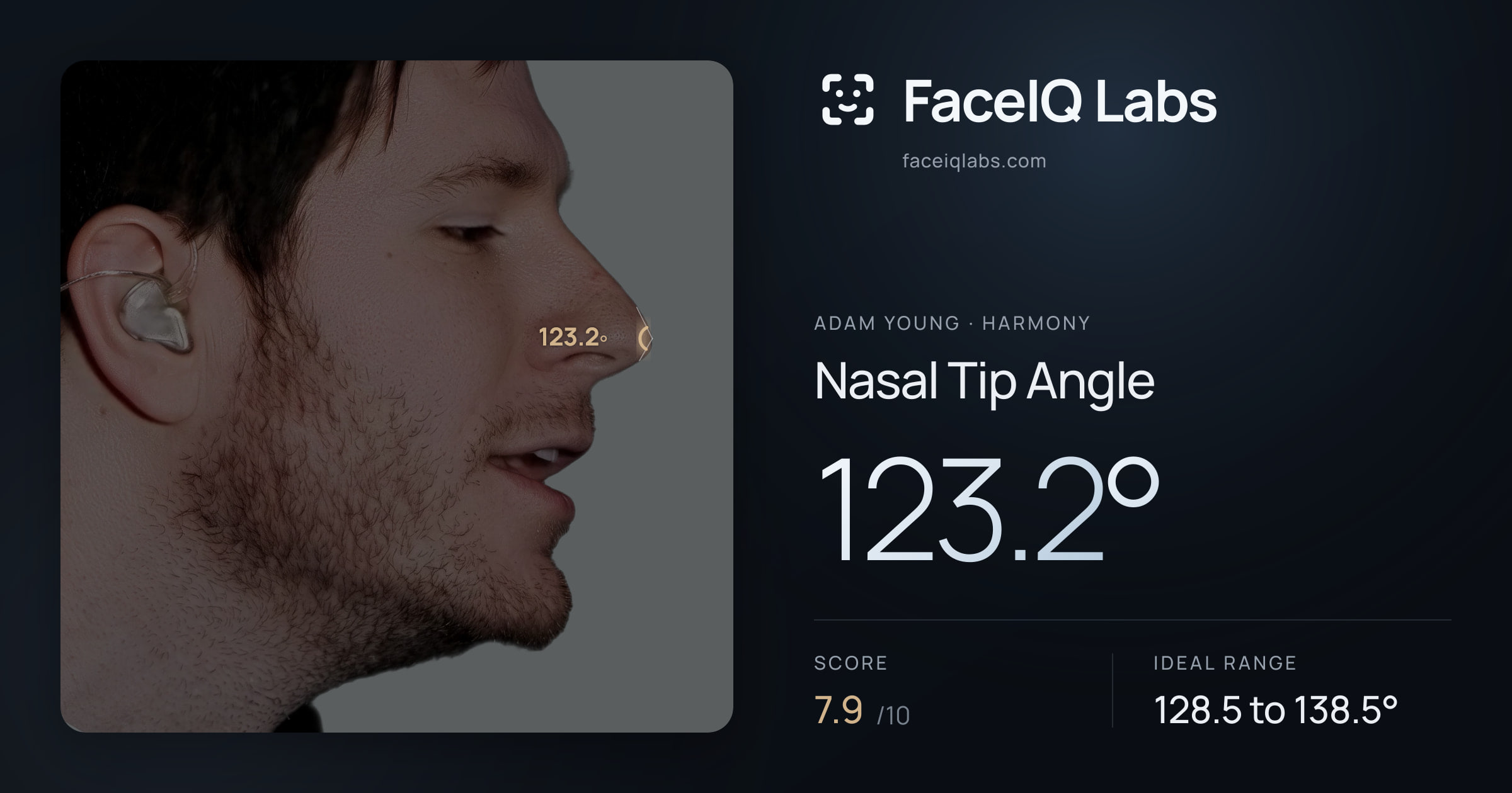 Adam Young Nasal Tip Angle: 123.2°, drawn on the photo