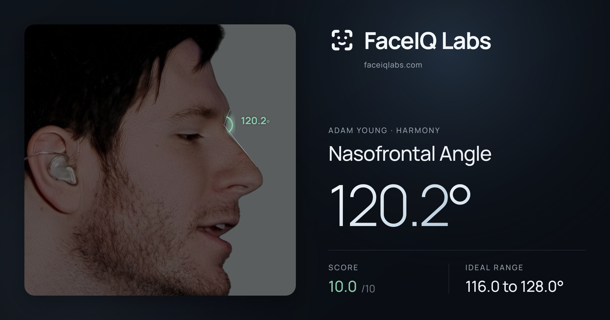 Adam Young Nasofrontal Angle: 120.2°, drawn on the photo