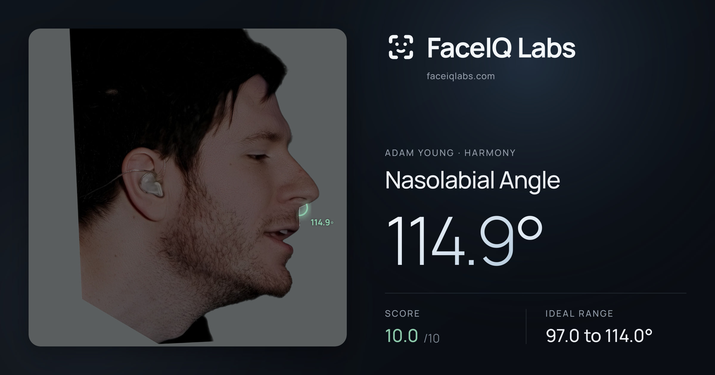 Adam Young Nasolabial Angle: 114.9°, drawn on the photo