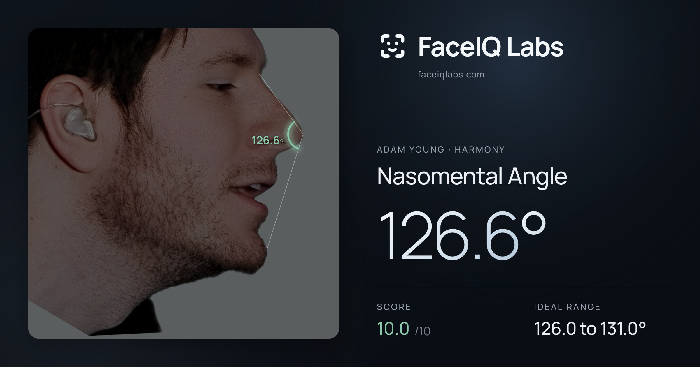 Adam Young Nasomental Angle: 126.6°, drawn on the photo