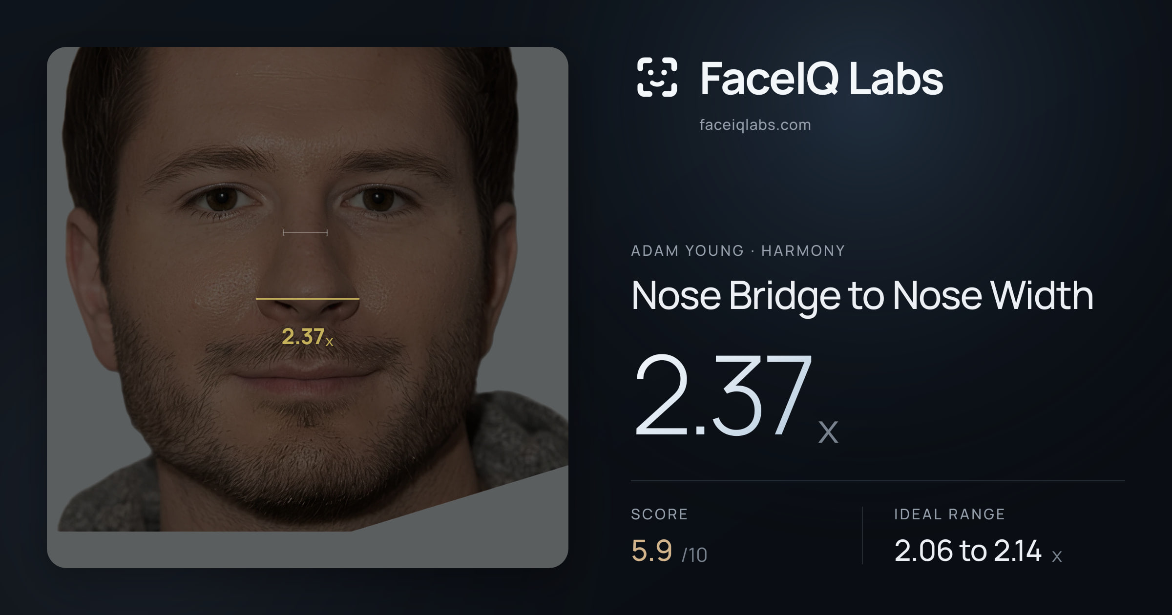 Adam Young Nose Bridge to Nose Width: 2.37x, drawn on the photo