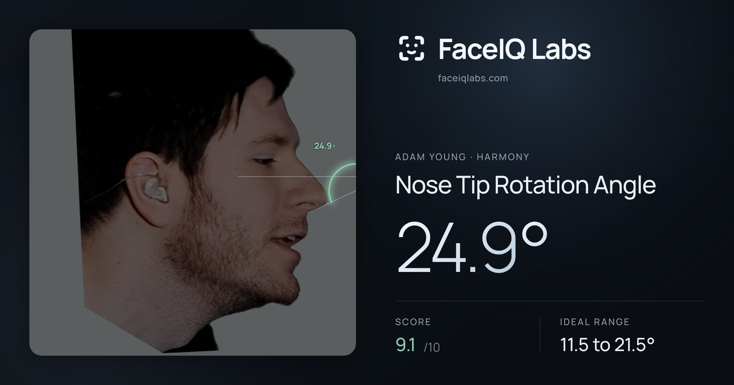 Adam Young Nose Tip Rotation Angle: 24.9°, drawn on the photo