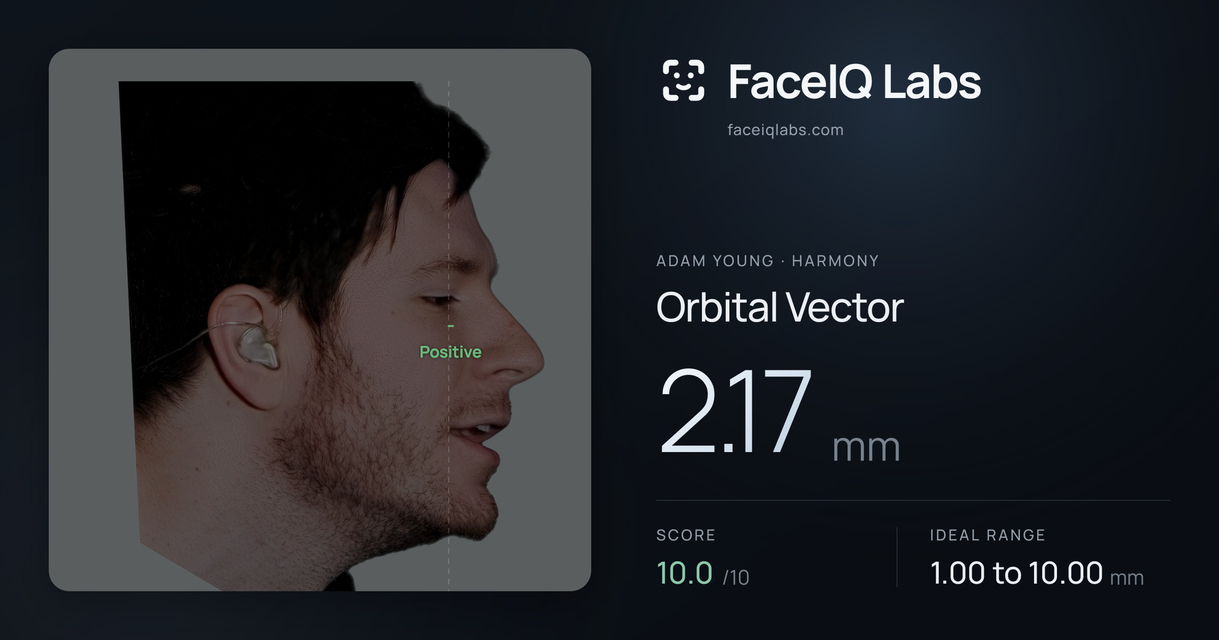 Adam Young Orbital Vector: 2.17mm, drawn on the photo
