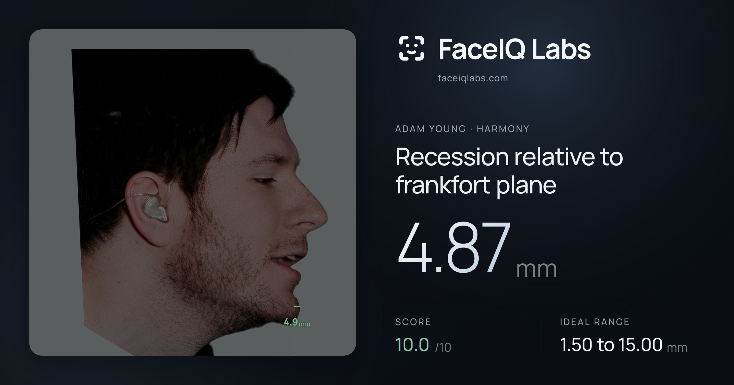 Adam Young Recession relative to frankfort plane: 4.87mm, drawn on the photo