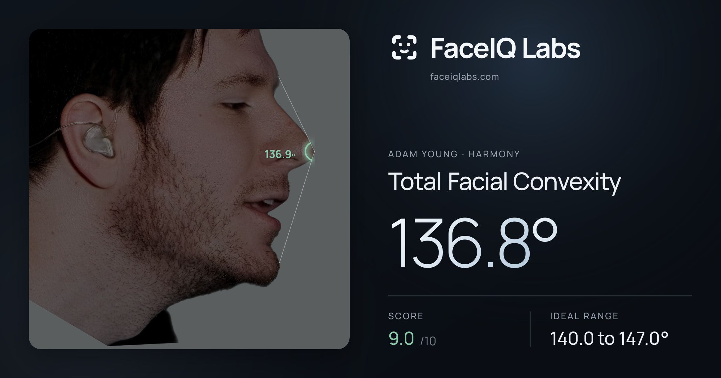 Adam Young Total Facial Convexity: 136.8°, drawn on the photo