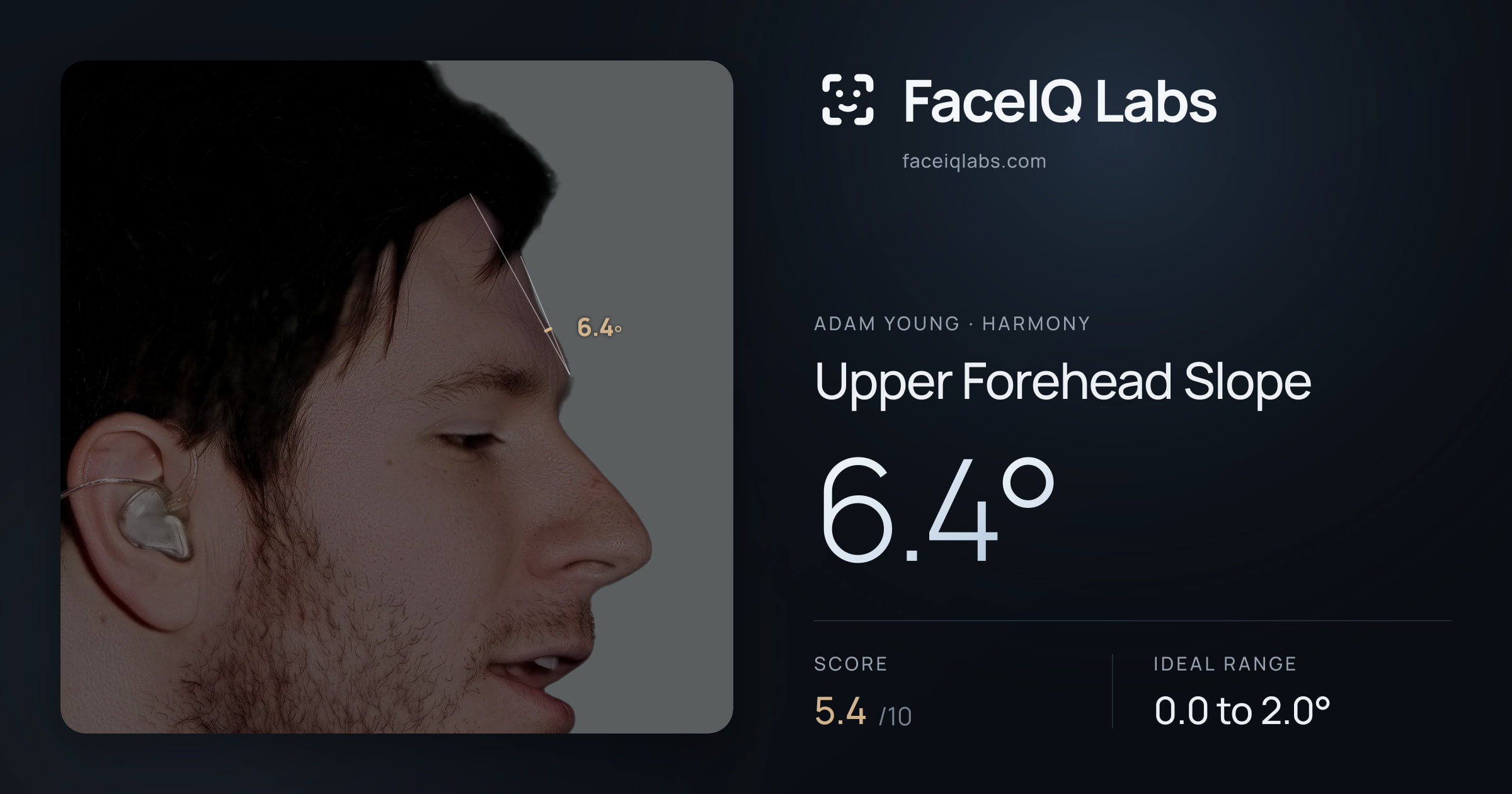 Adam Young Upper Forehead Slope: 6.4°, drawn on the photo