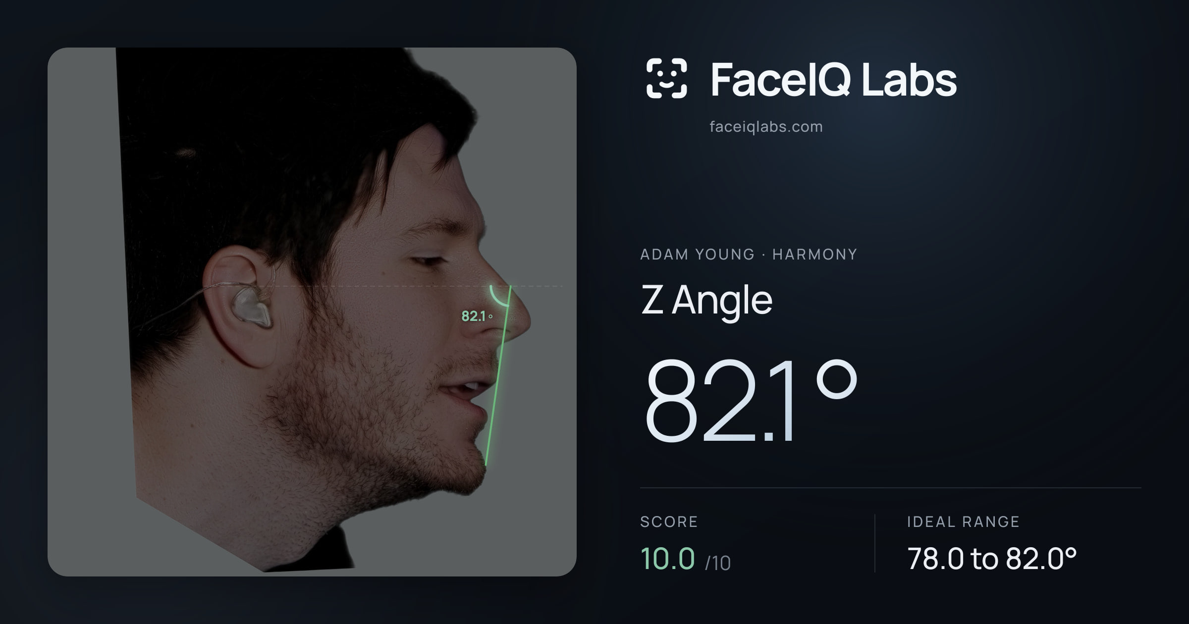 Adam Young Z Angle: 82.1°, drawn on the photo