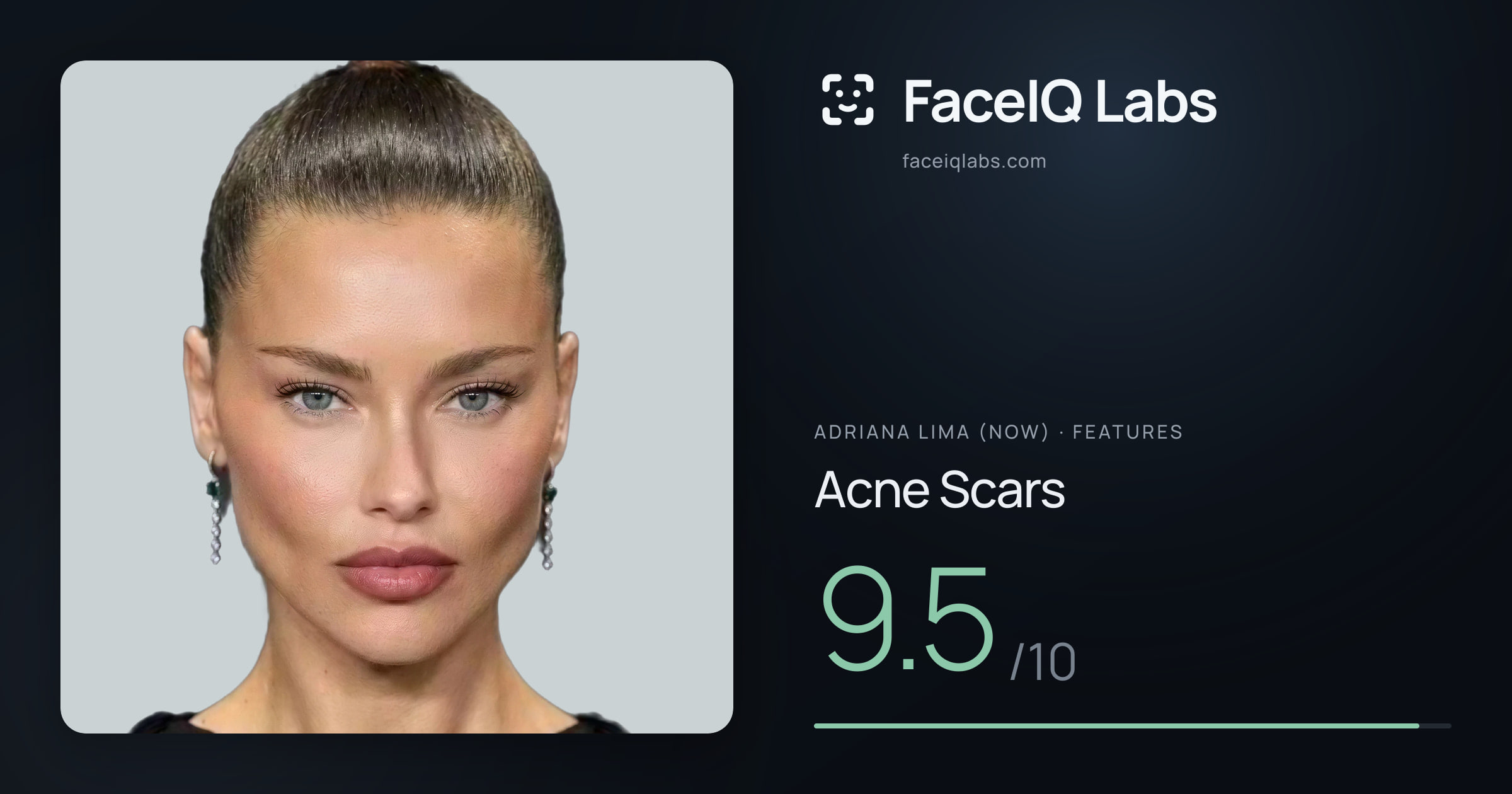 Adriana lima (now) Acne Scars: 9.5/10, drawn on the photo