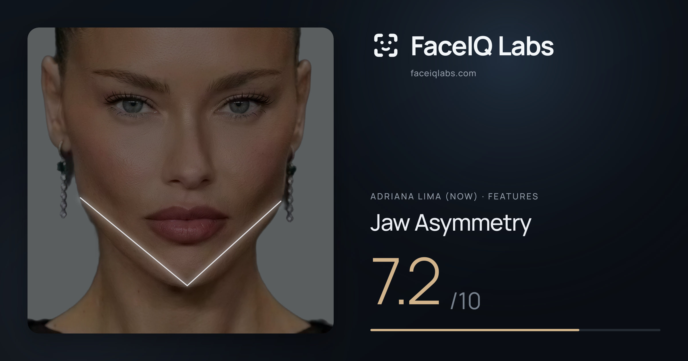 Adriana lima (now) Jaw Asymmetry: 7.2/10, drawn on the photo