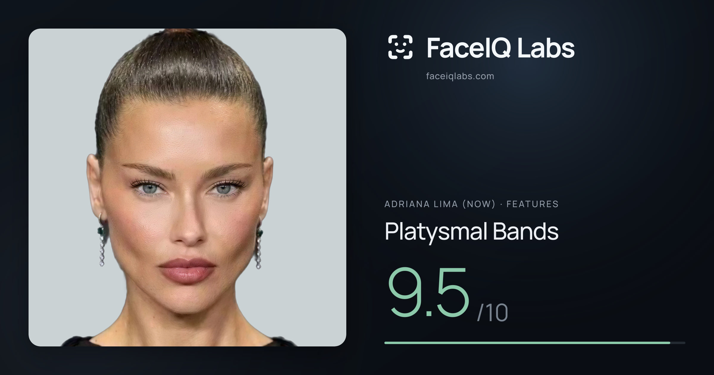Adriana lima (now) Platysmal Bands: 9.5/10, drawn on the photo