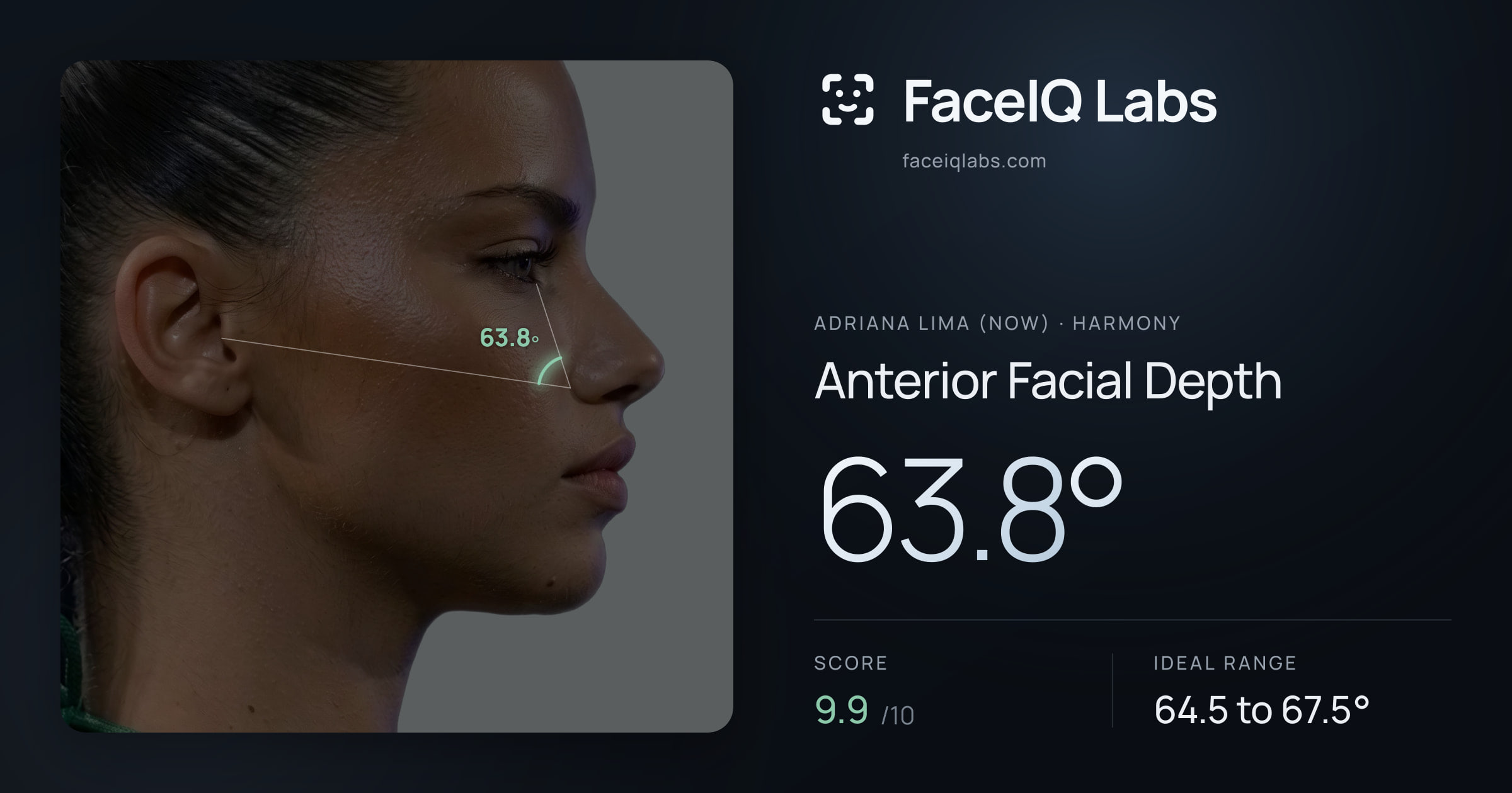 Adriana lima (now) Anterior Facial Depth: 63.8°, drawn on the photo
