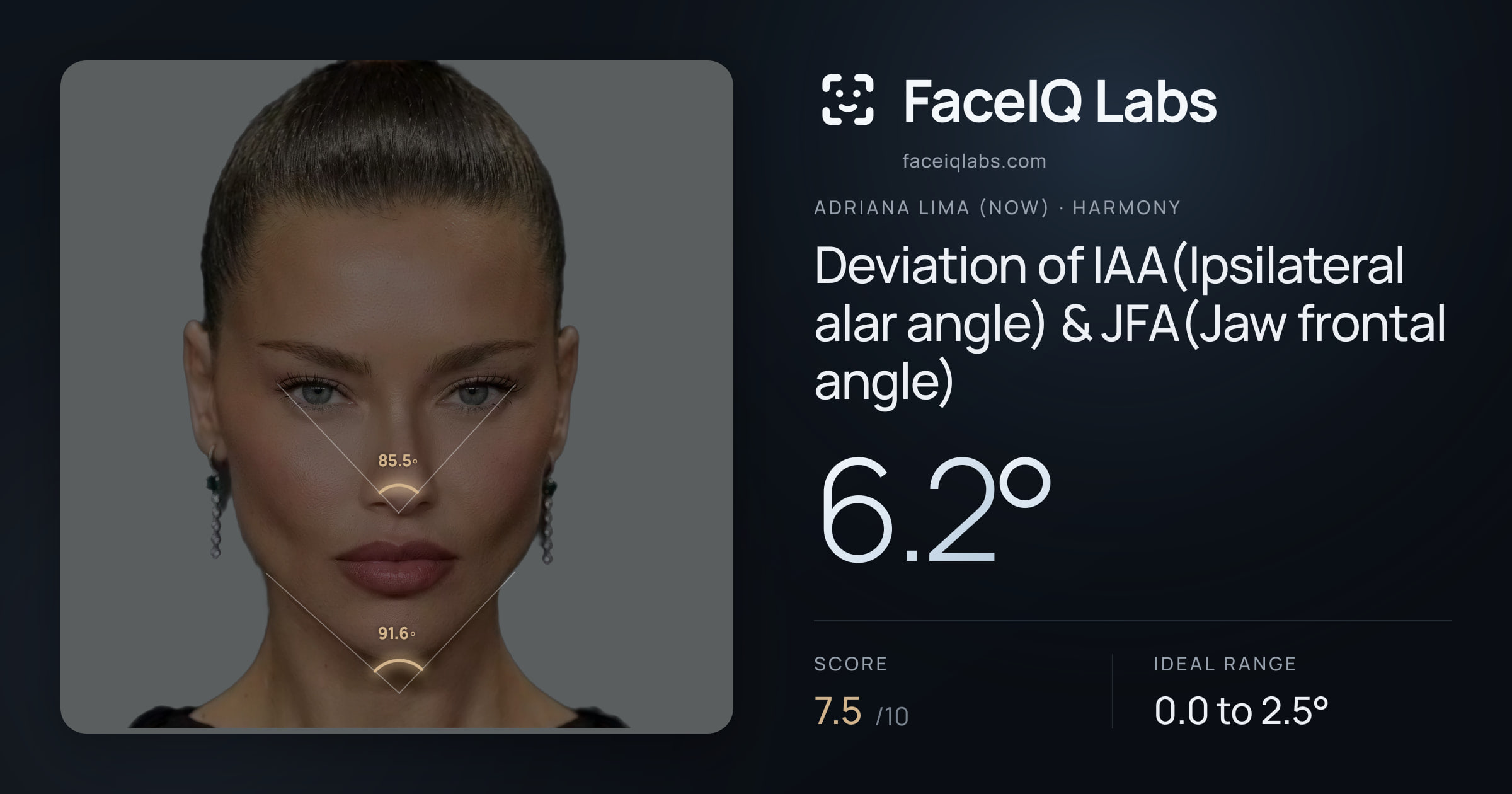Adriana lima (now) Deviation of IAA(Ipsilateral alar angle) & JFA(Jaw frontal angle): 6.2°, drawn on the photo