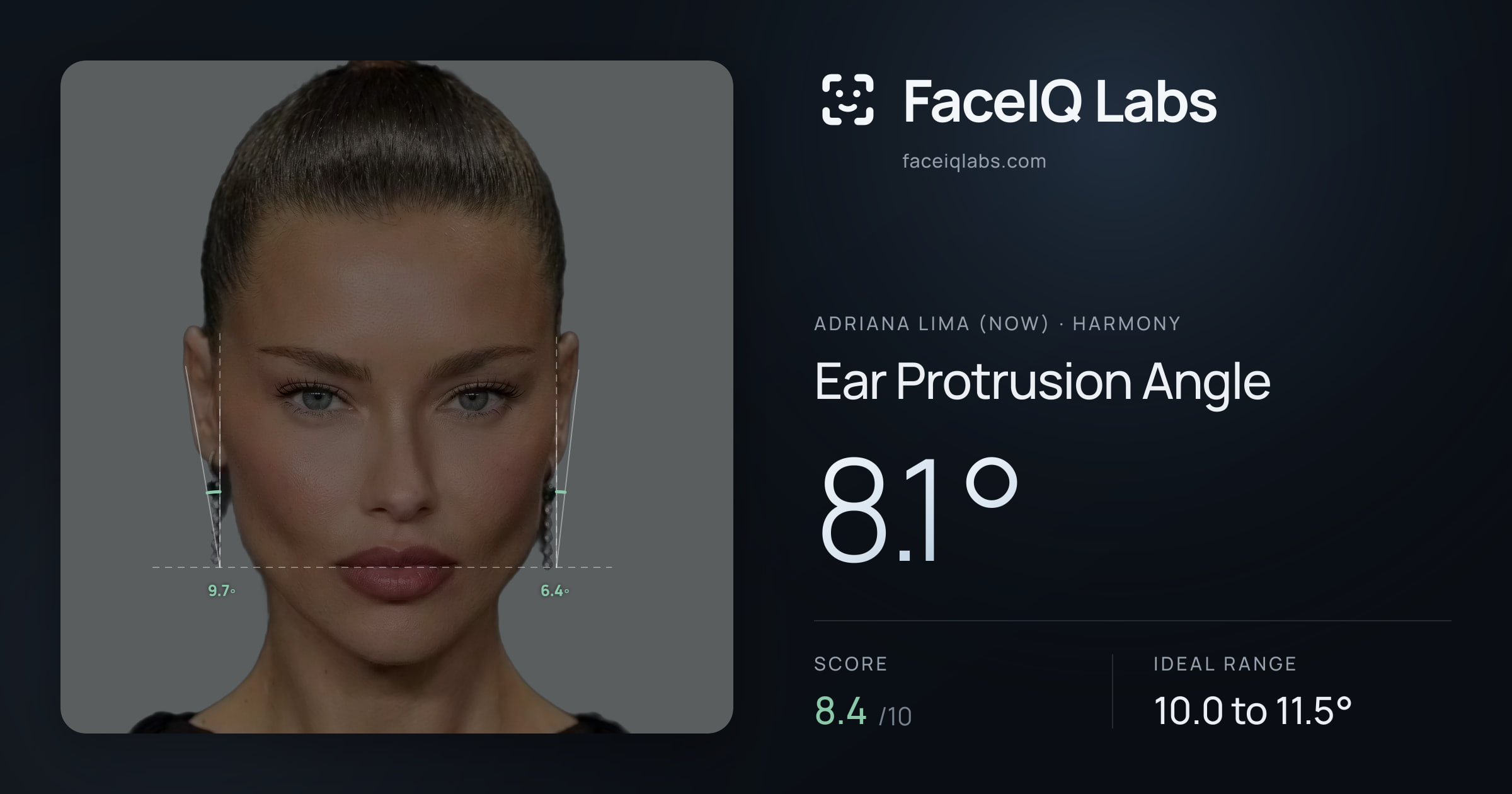Adriana lima (now) Ear Protrusion Angle: 8.1°, drawn on the photo