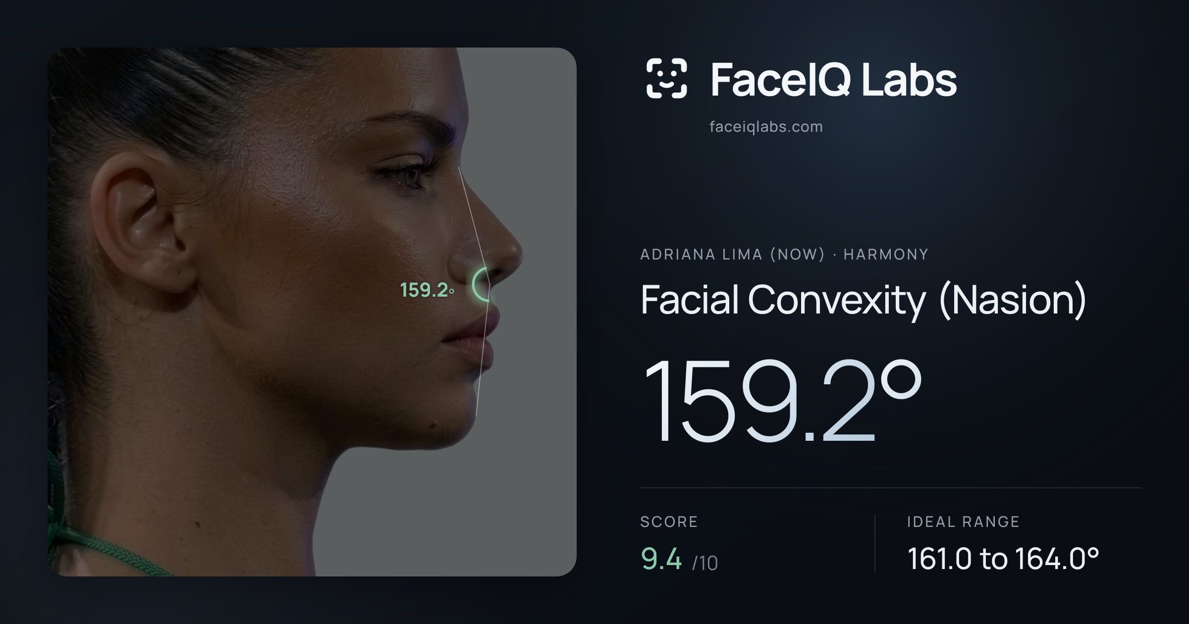 Adriana lima (now) Facial Convexity (Nasion): 159.2°, drawn on the photo