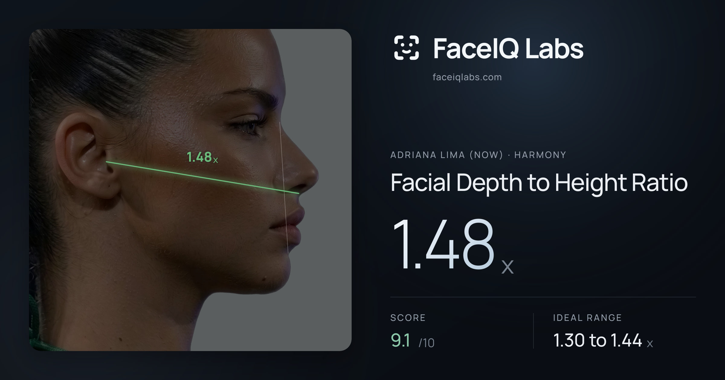 Adriana lima (now) Facial Depth to Height Ratio: 1.48x, drawn on the photo