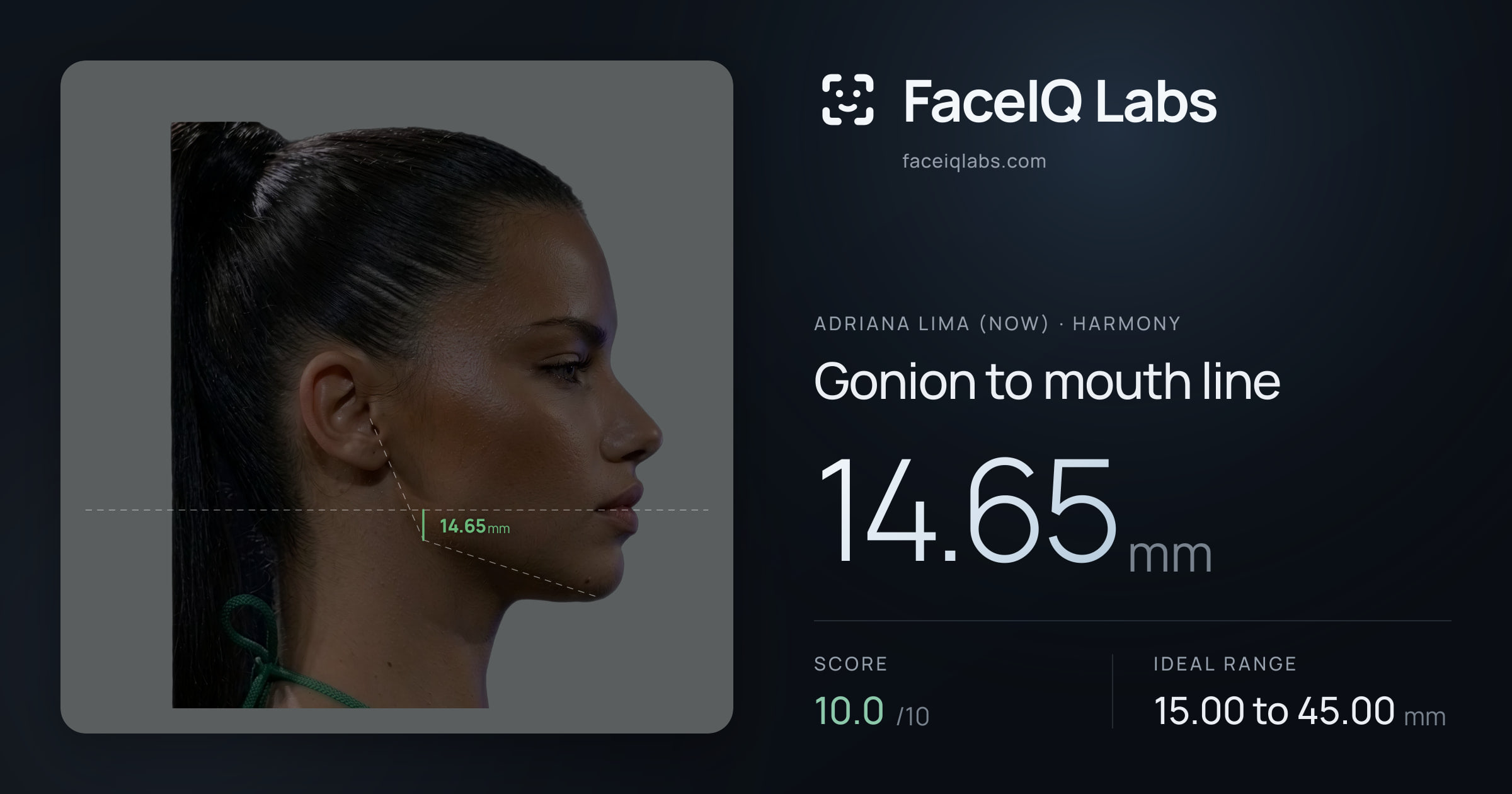 Adriana lima (now) Gonion to mouth line: 14.65mm, drawn on the photo