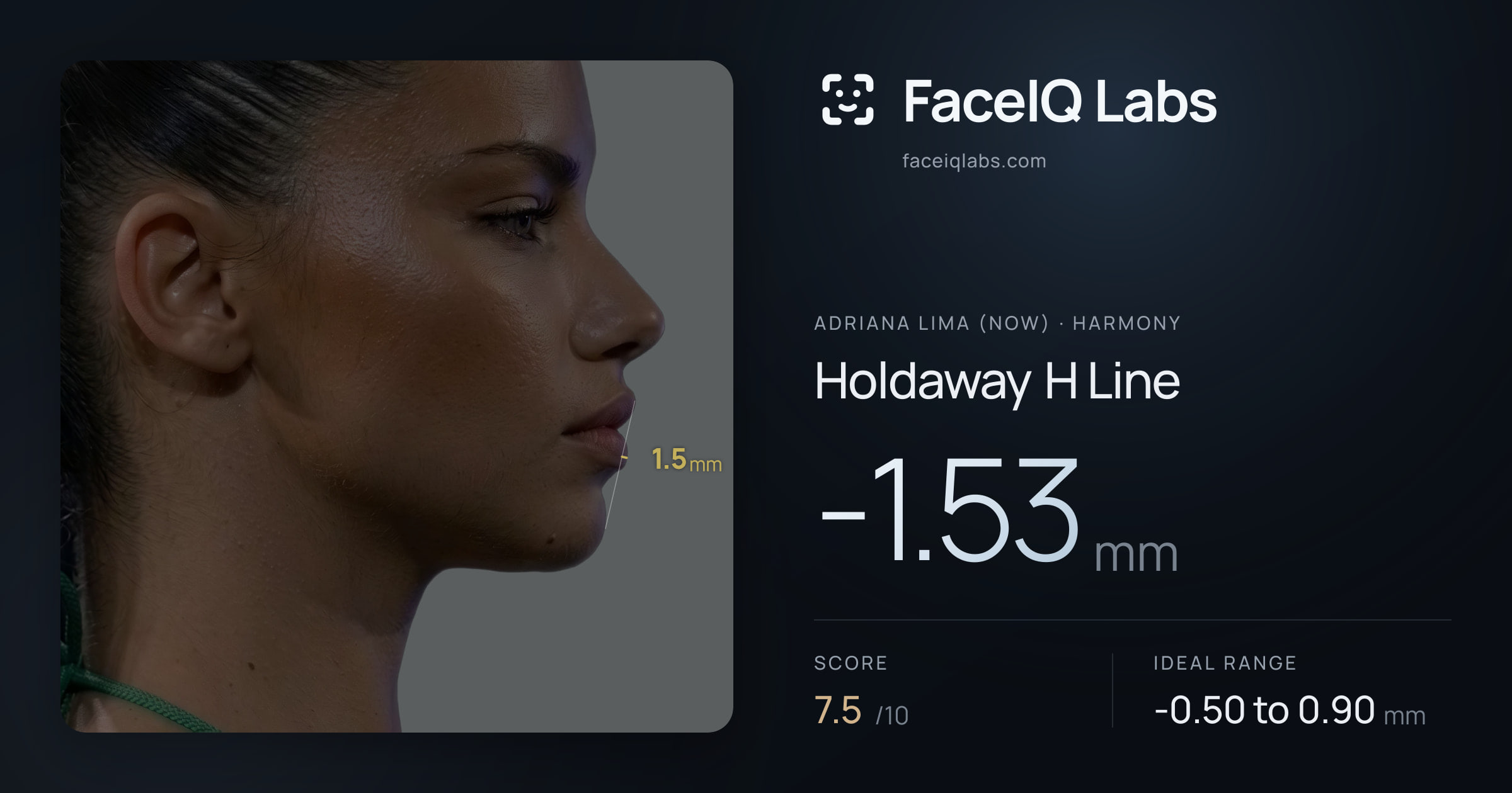Adriana lima (now) Holdaway H Line: -1.53mm, drawn on the photo