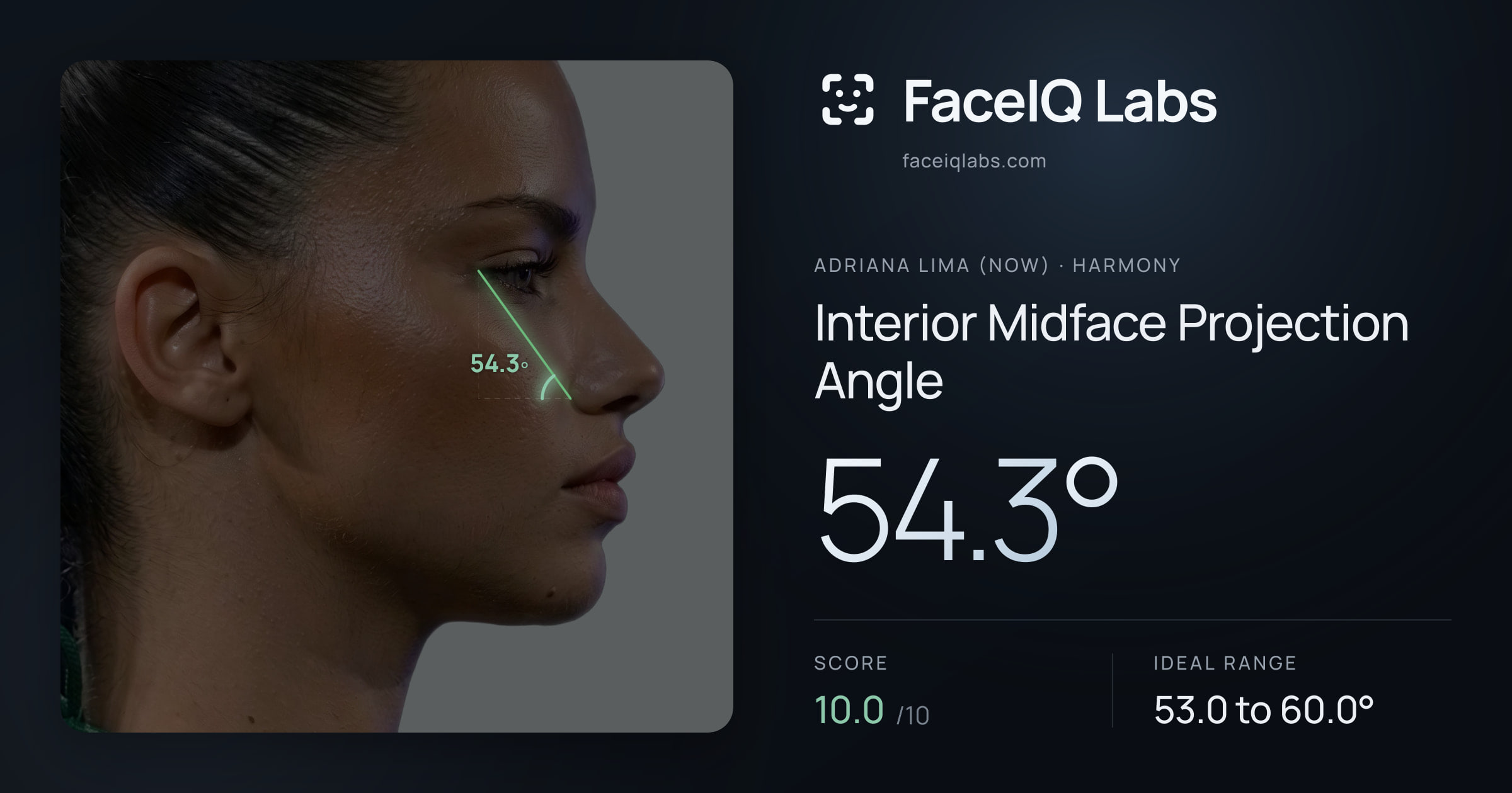 Adriana lima (now) Interior Midface Projection Angle: 54.3°, drawn on the photo