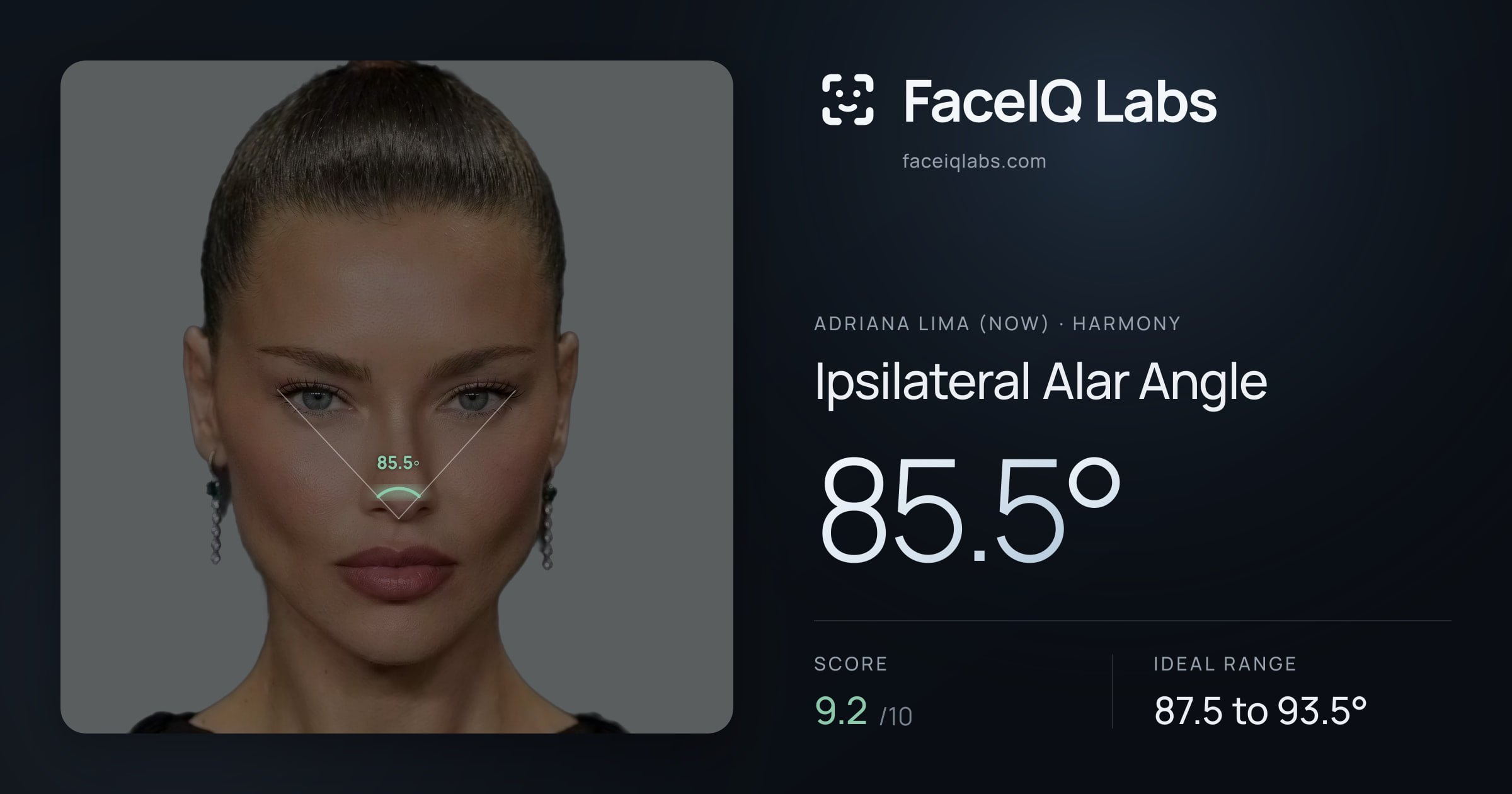 Adriana lima (now) Ipsilateral Alar Angle: 85.5°, drawn on the photo
