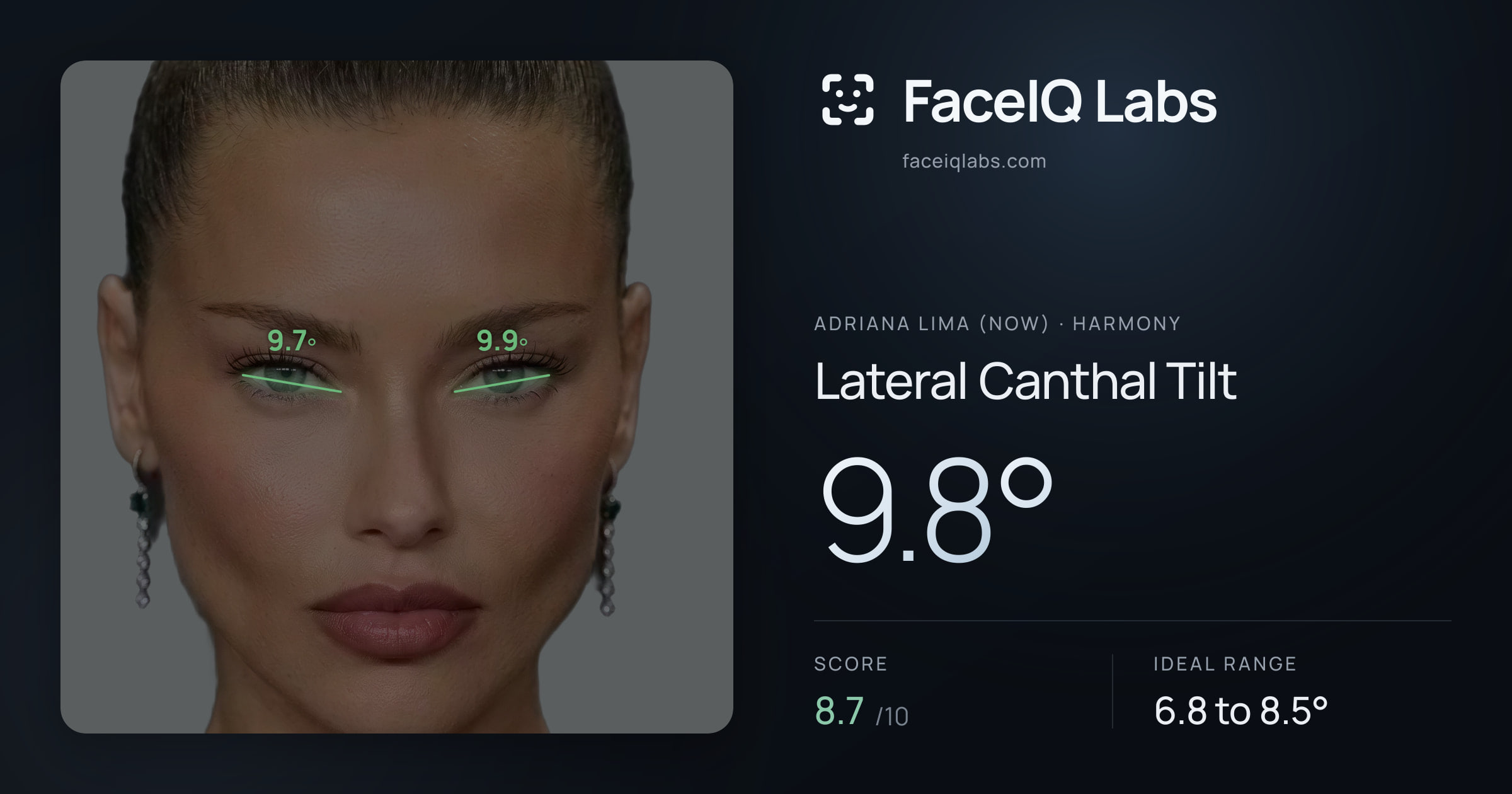 Adriana lima (now) Lateral Canthal Tilt: 9.8°, drawn on the photo