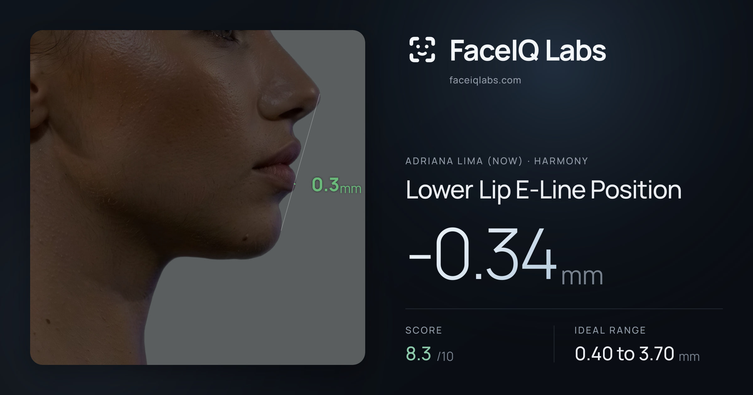 Adriana lima (now) Lower Lip E-Line Position: -0.34mm, drawn on the photo