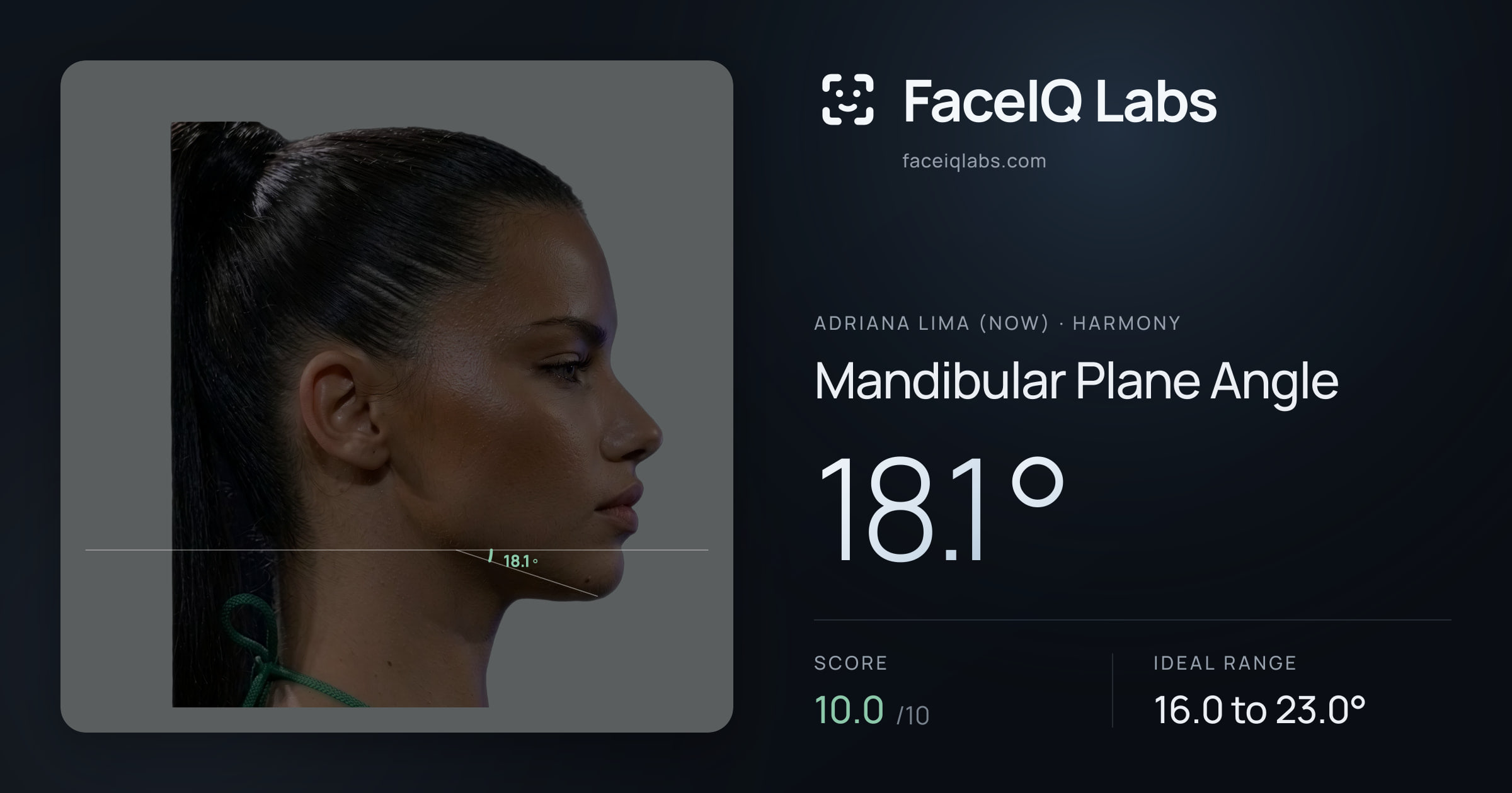 Adriana lima (now) Mandibular Plane Angle: 18.1°, drawn on the photo