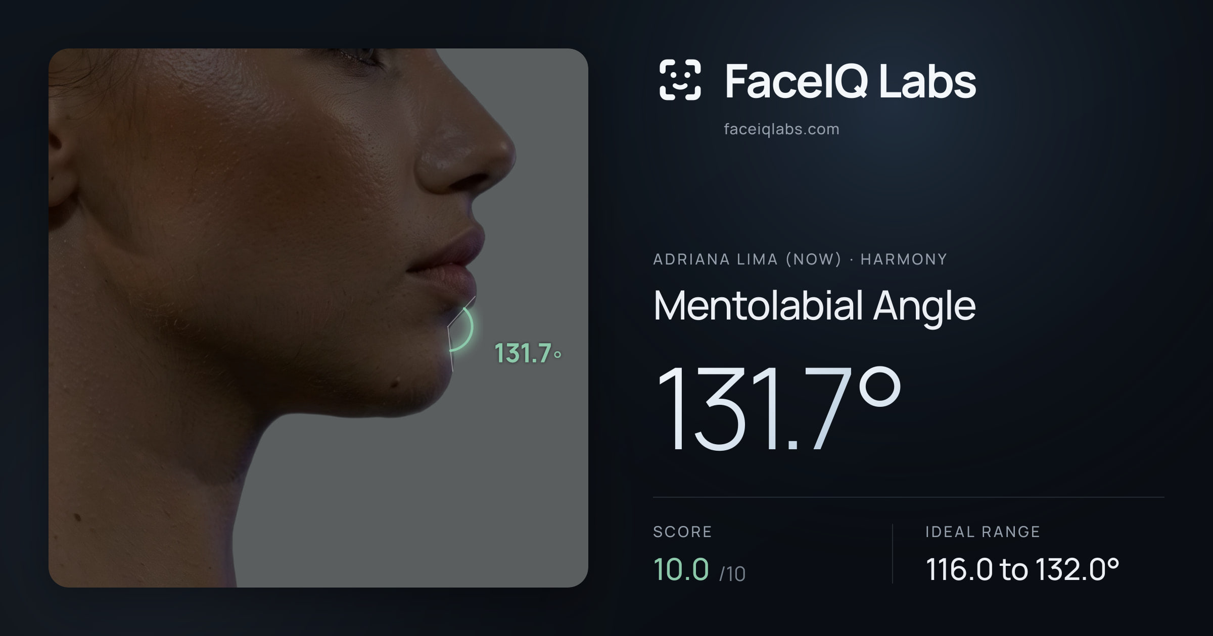 Adriana lima (now) Mentolabial Angle: 131.7°, drawn on the photo