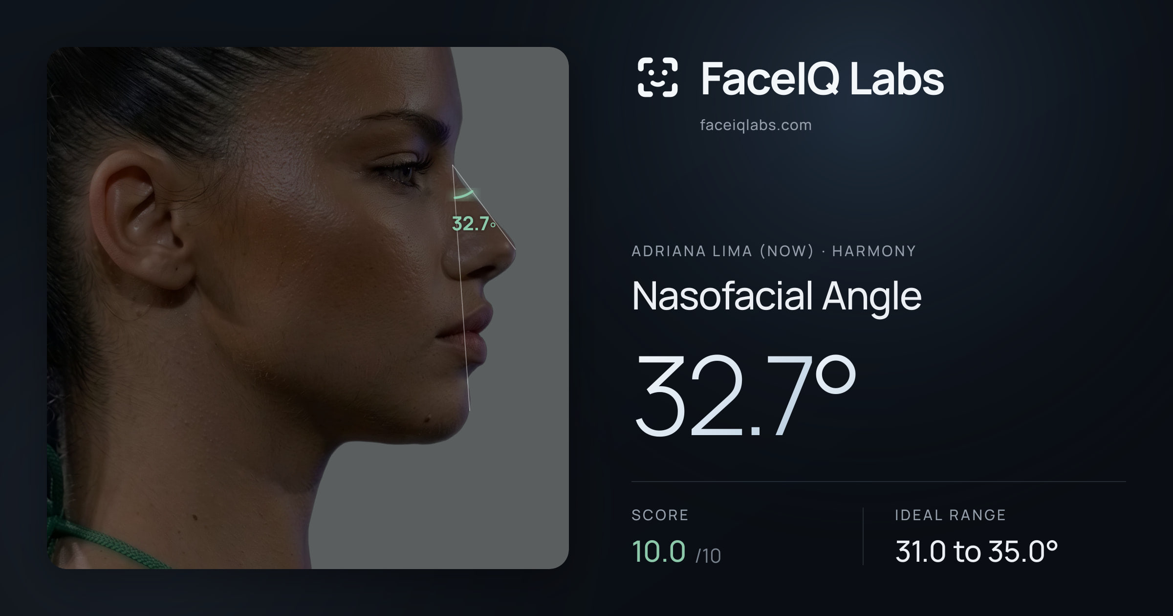 Adriana lima (now) Nasofacial Angle: 32.7°, drawn on the photo