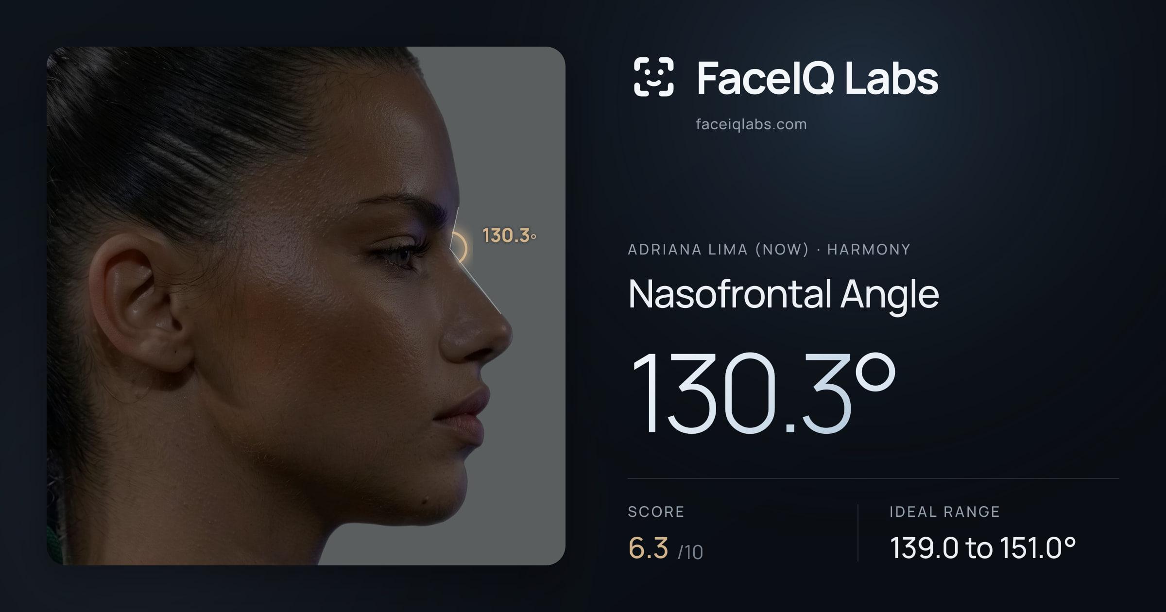 Adriana lima (now) Nasofrontal Angle: 130.3°, drawn on the photo