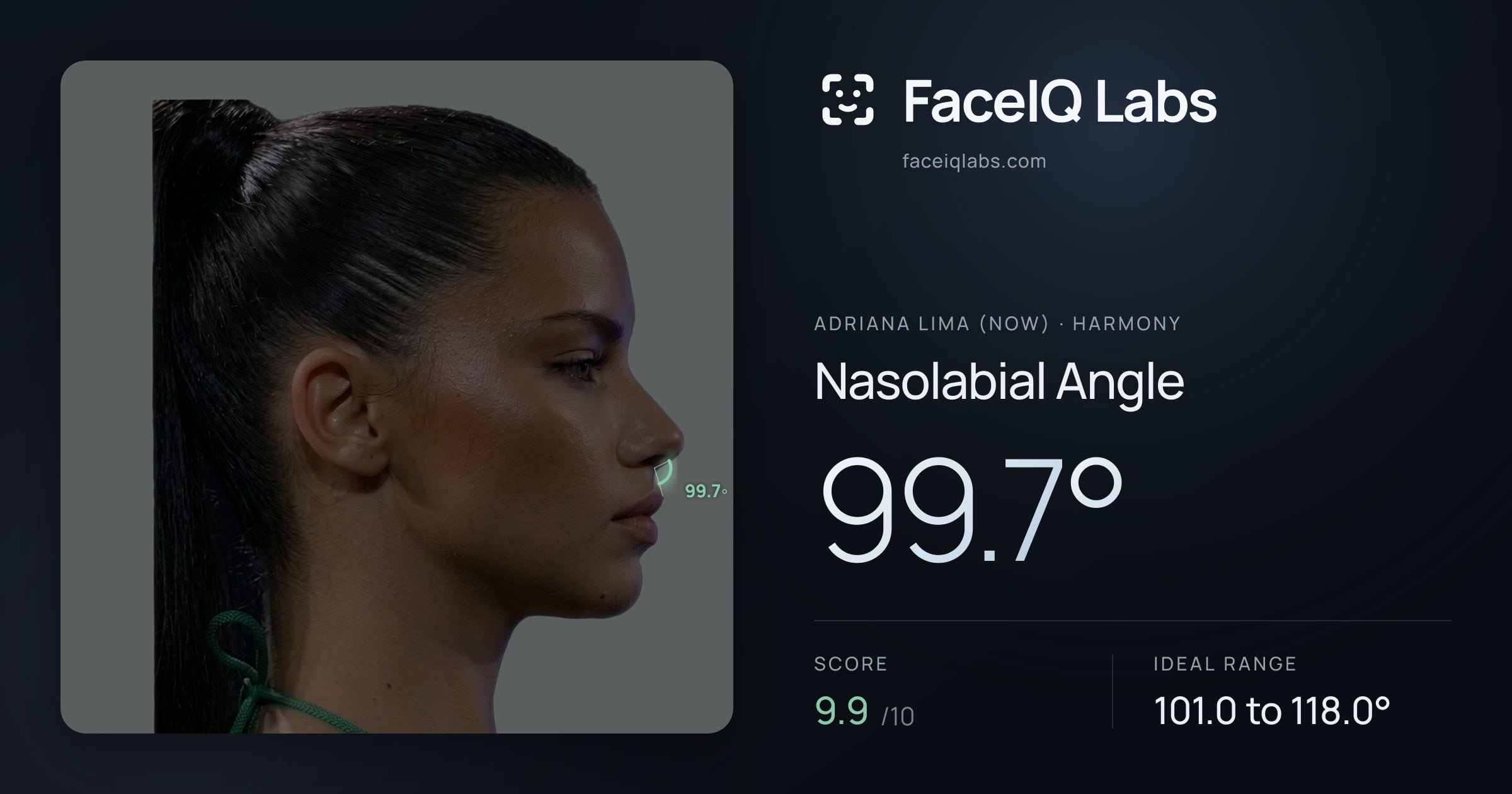 Adriana lima (now) Nasolabial Angle: 99.7°, drawn on the photo