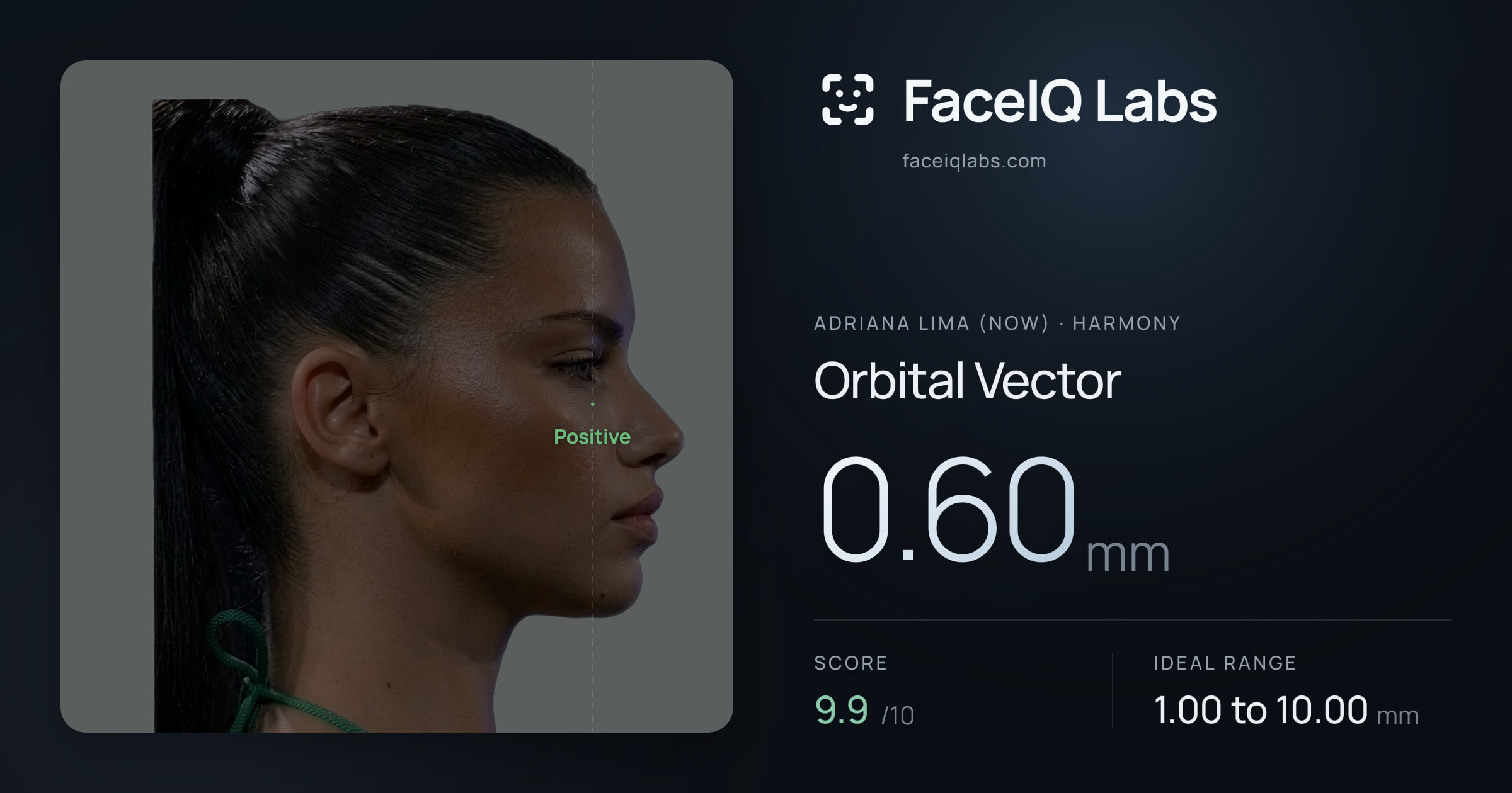 Adriana lima (now) Orbital Vector: 0.60mm, drawn on the photo
