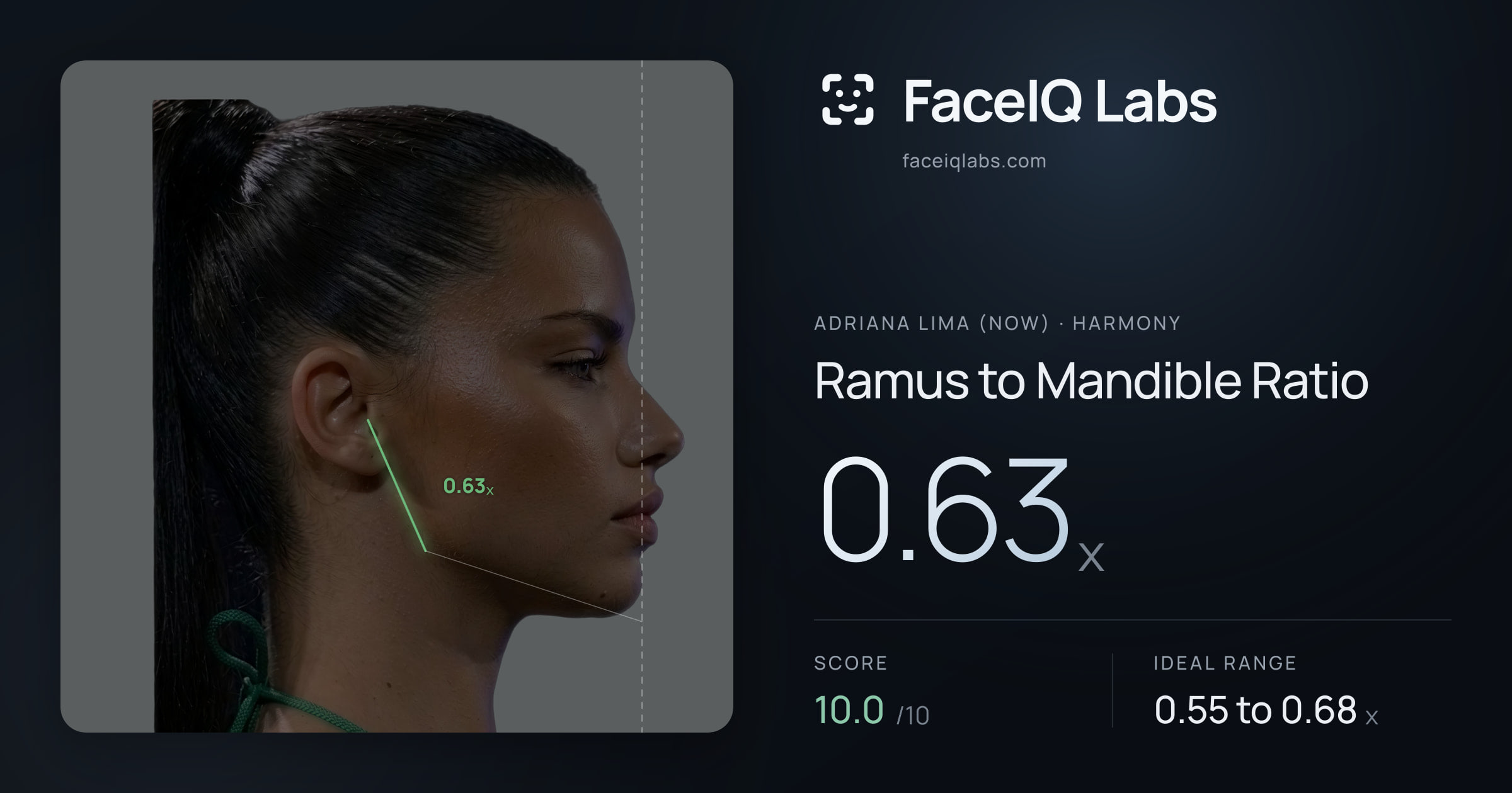 Adriana lima (now) Ramus to Mandible Ratio: 0.63x, drawn on the photo