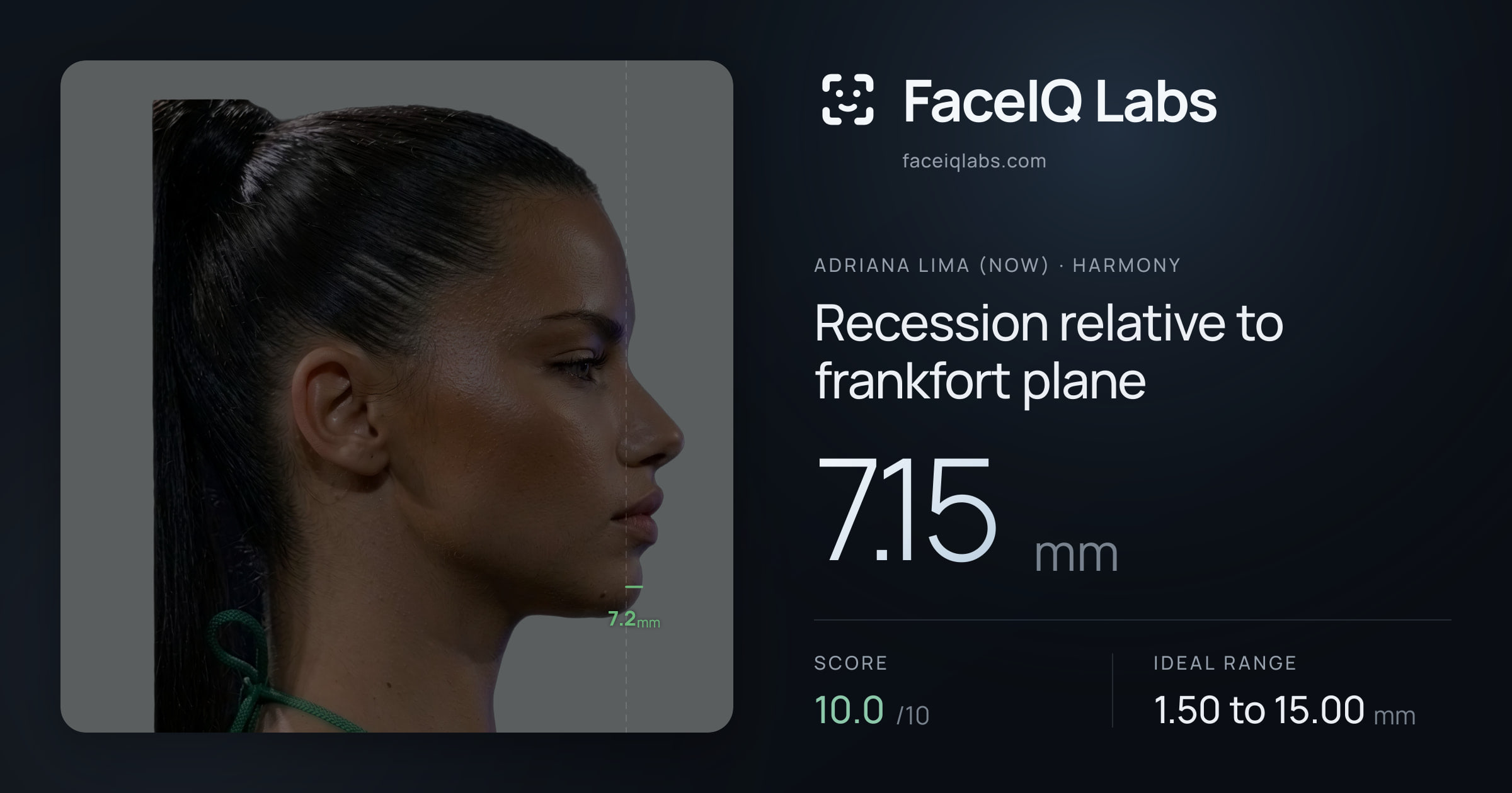 Adriana lima (now) Recession relative to frankfort plane: 7.15mm, drawn on the photo