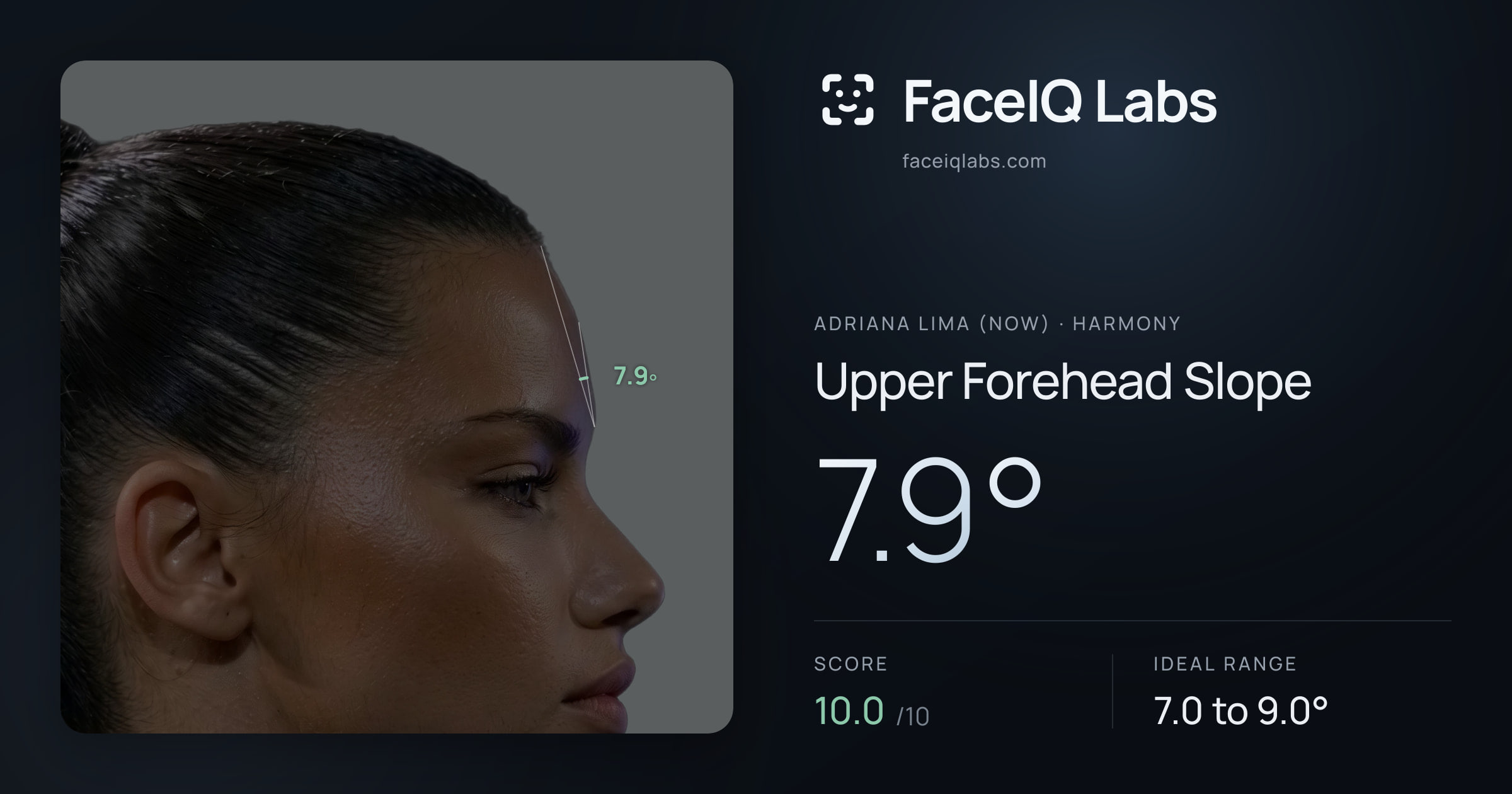 Adriana lima (now) Upper Forehead Slope: 7.9°, drawn on the photo