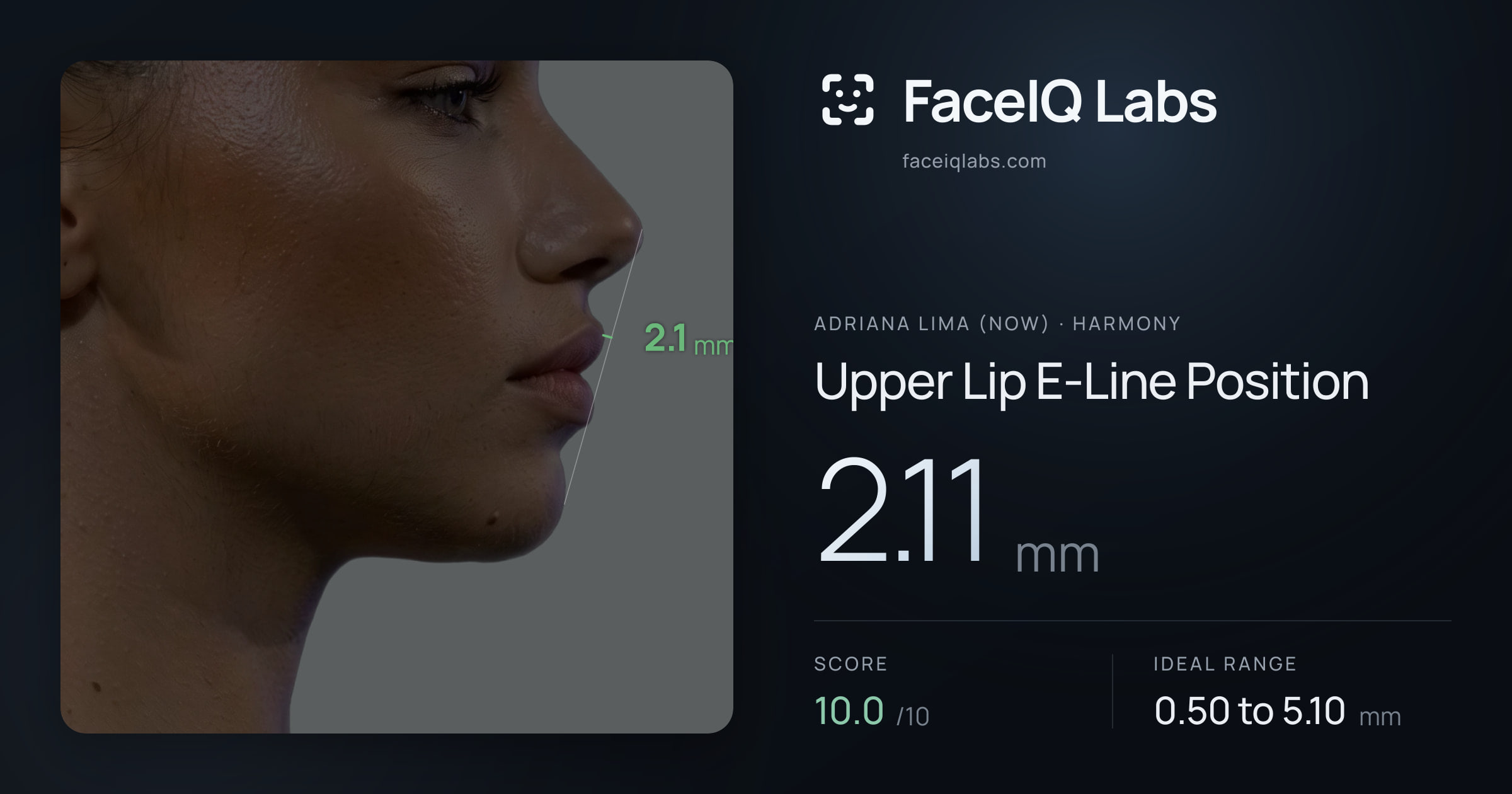 Adriana lima (now) Upper Lip E-Line Position: 2.11mm, drawn on the photo