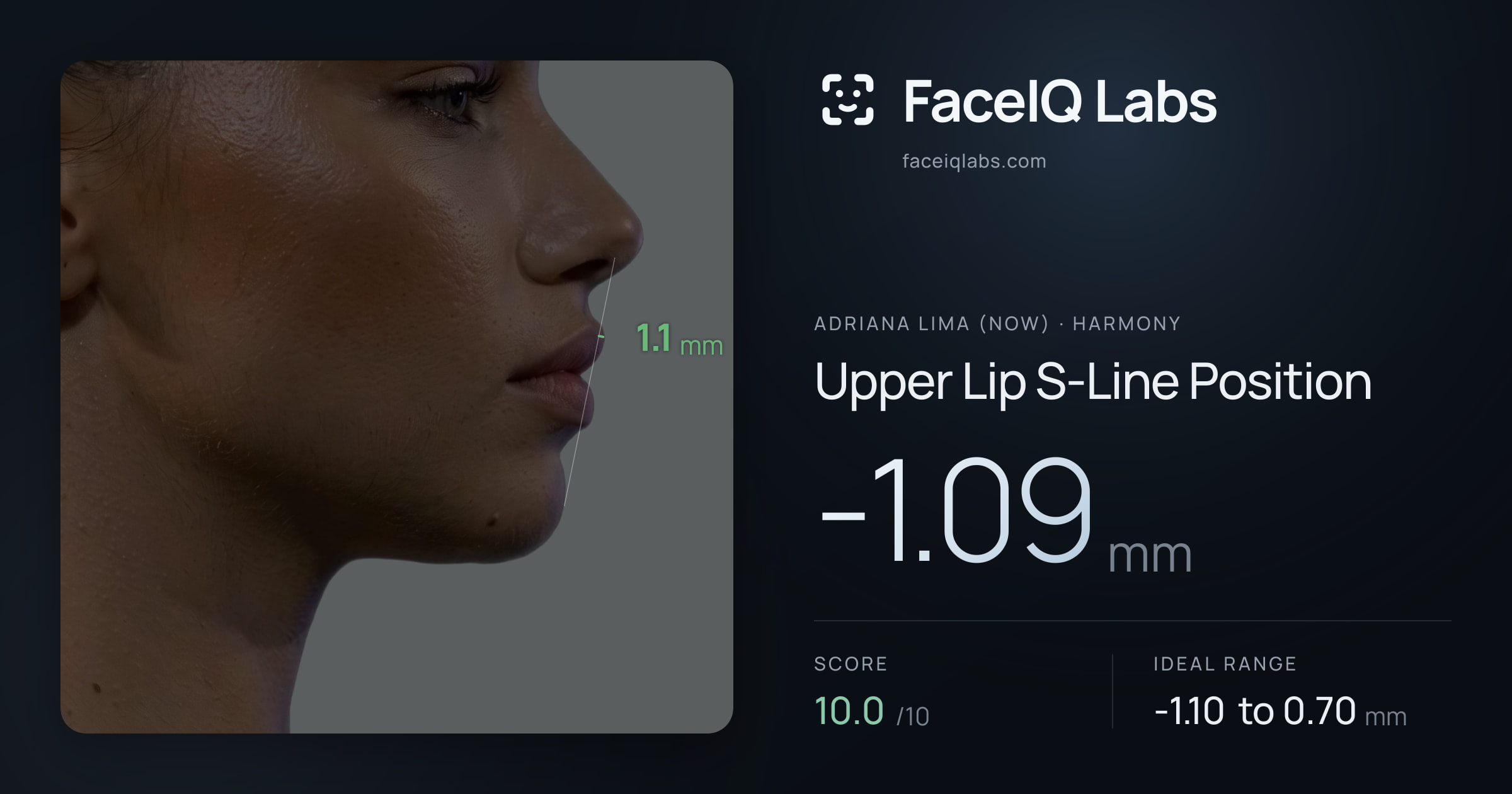Adriana lima (now) Upper Lip S-Line Position: -1.09mm, drawn on the photo