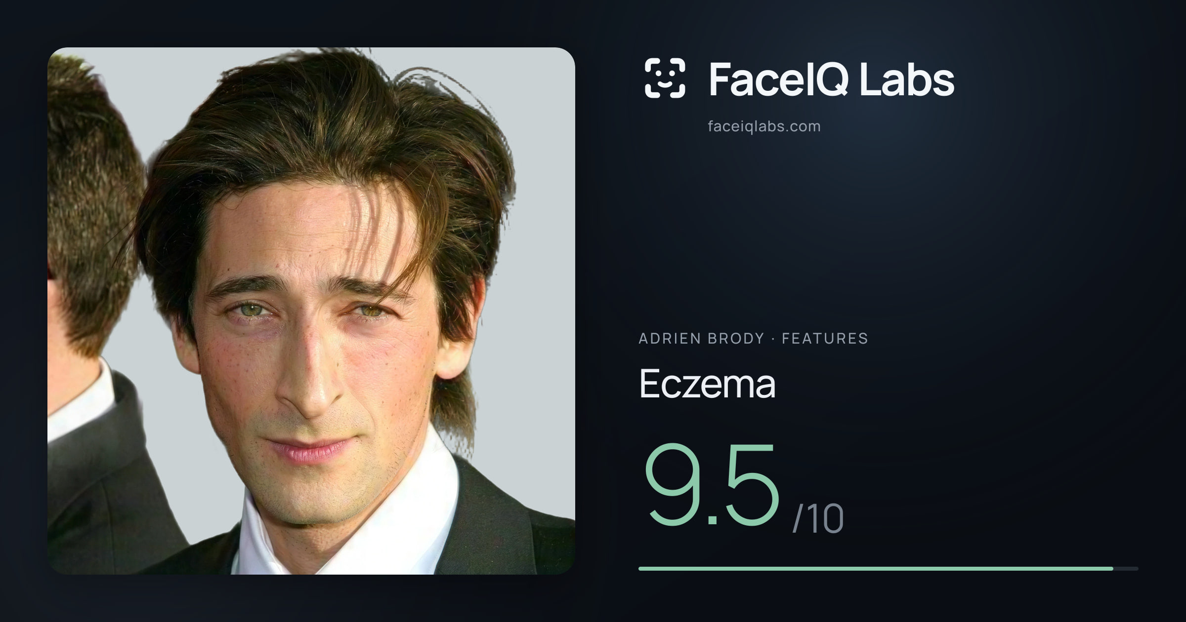 Adrien Brody Eczema: 9.5/10, drawn on the photo
