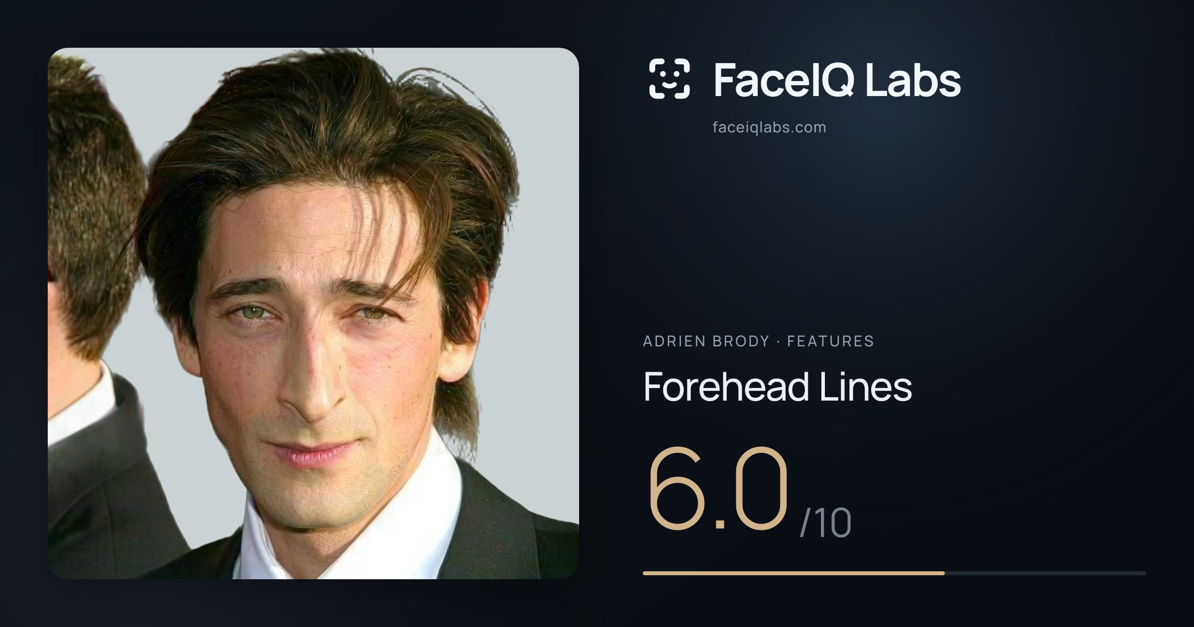 Adrien Brody Forehead Lines: 6.0/10, drawn on the photo
