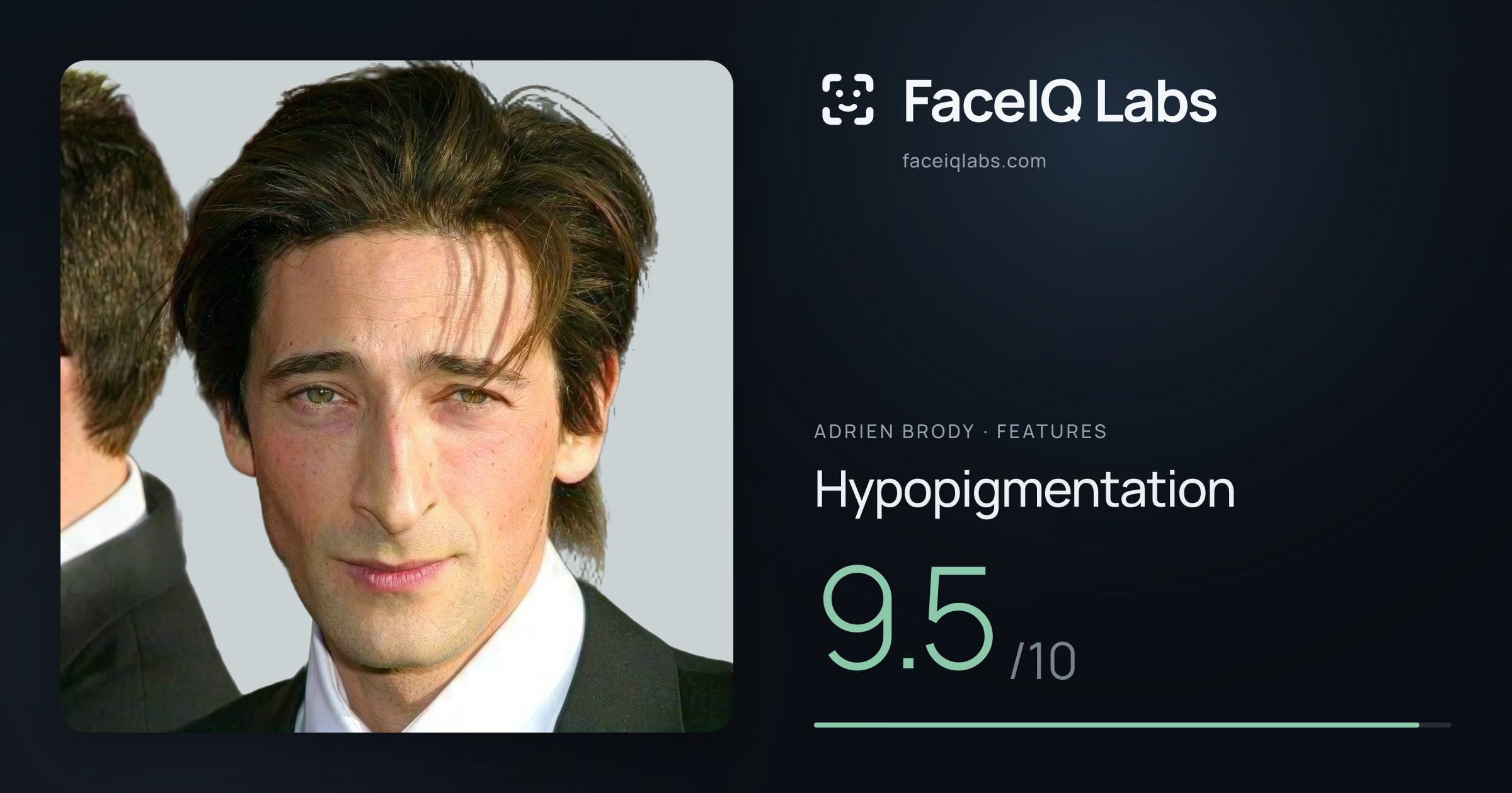 Adrien Brody Hypopigmentation: 9.5/10, drawn on the photo