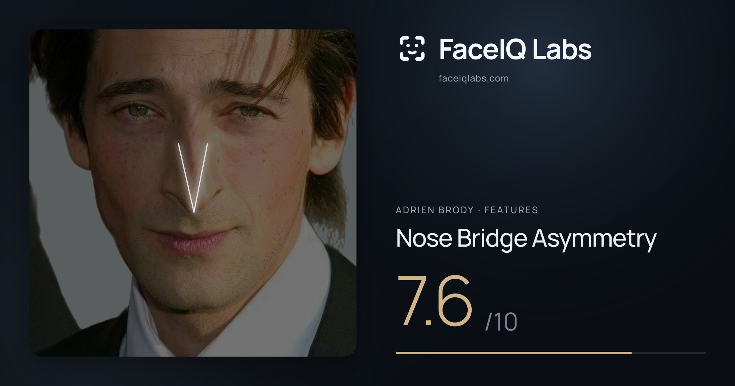 Adrien Brody Nose Bridge Asymmetry: 7.6/10, drawn on the photo