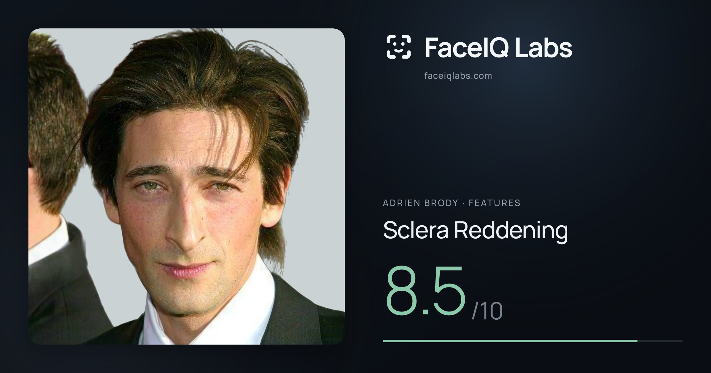 Adrien Brody Sclera Reddening: 8.5/10, drawn on the photo
