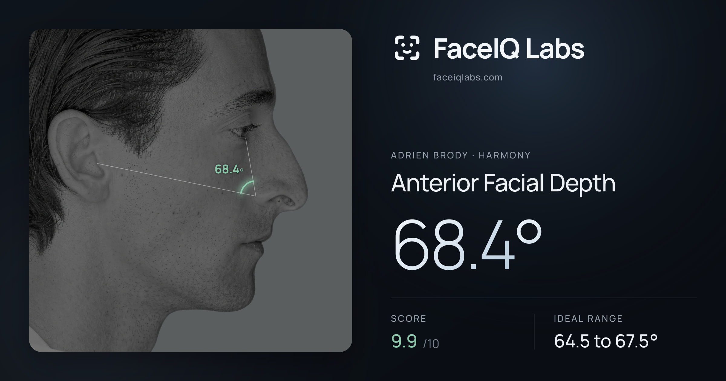 Adrien Brody Anterior Facial Depth: 68.4°, drawn on the photo